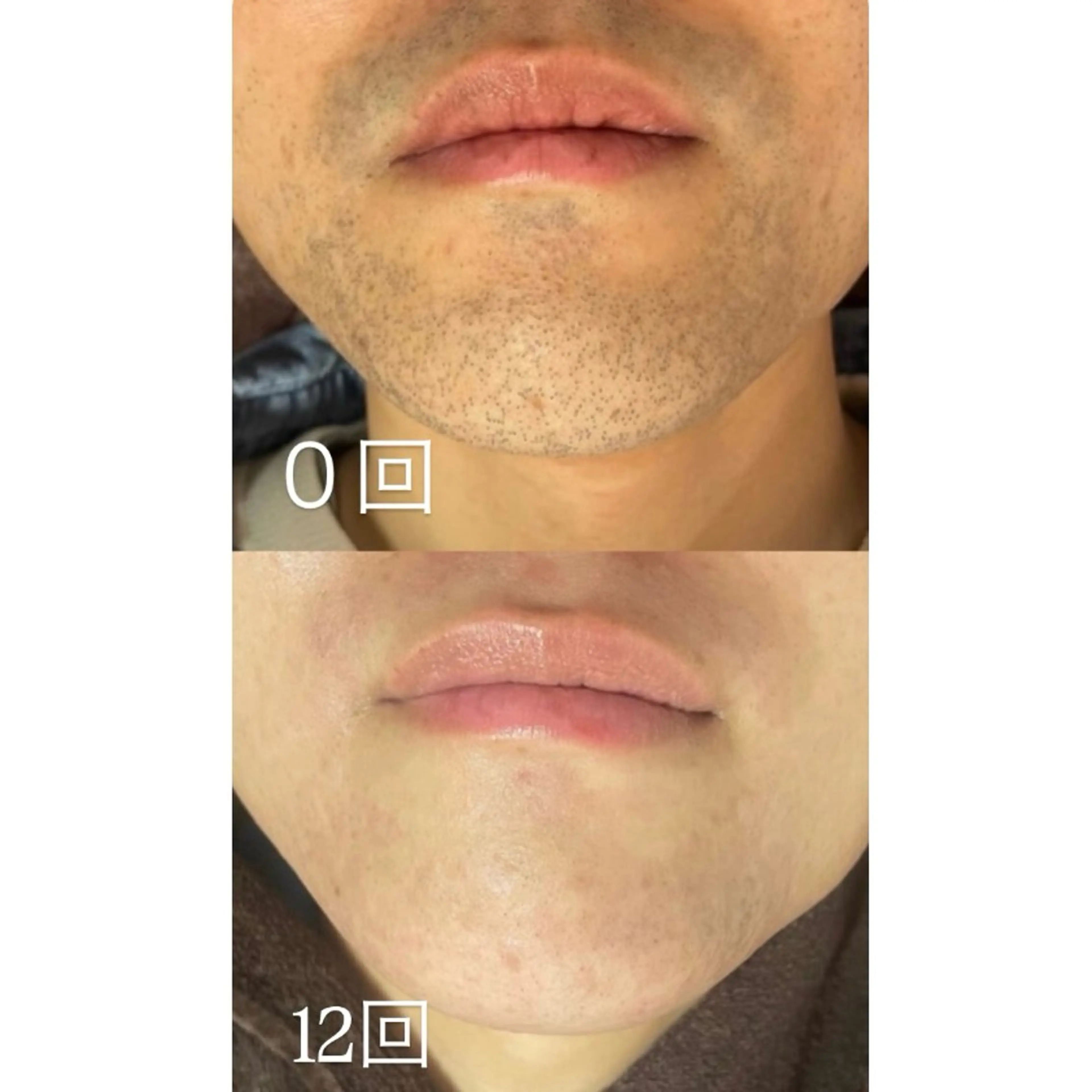 メンズ 津田沼店 Earthのエステ・リラクイメージ