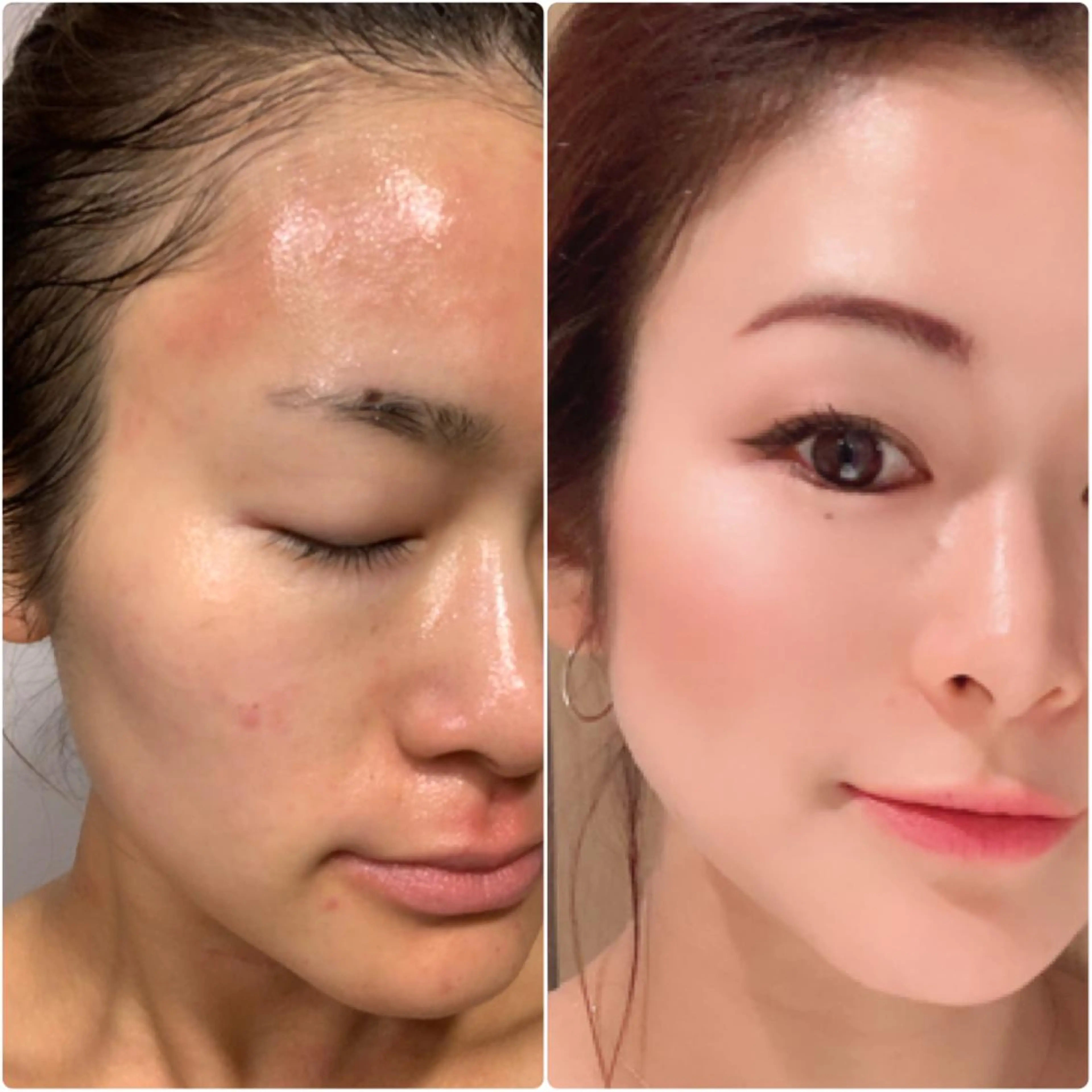 DeCoLé Beauty所属・艶肌/敏感肌/若さ/ ボディ痩身🌿のエステ・リラクイメージ