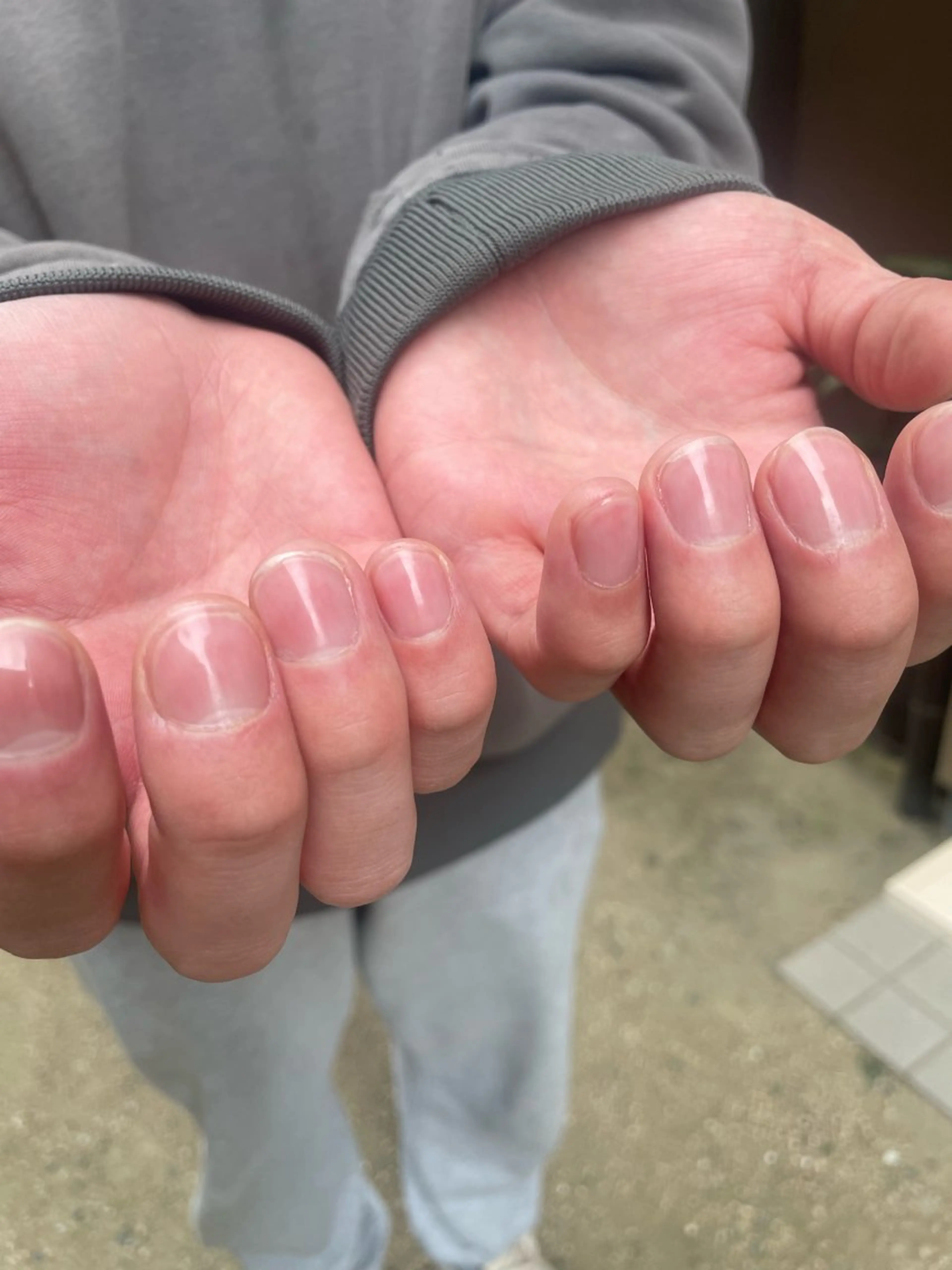 ネイルケア【ハンド/フット】の写真