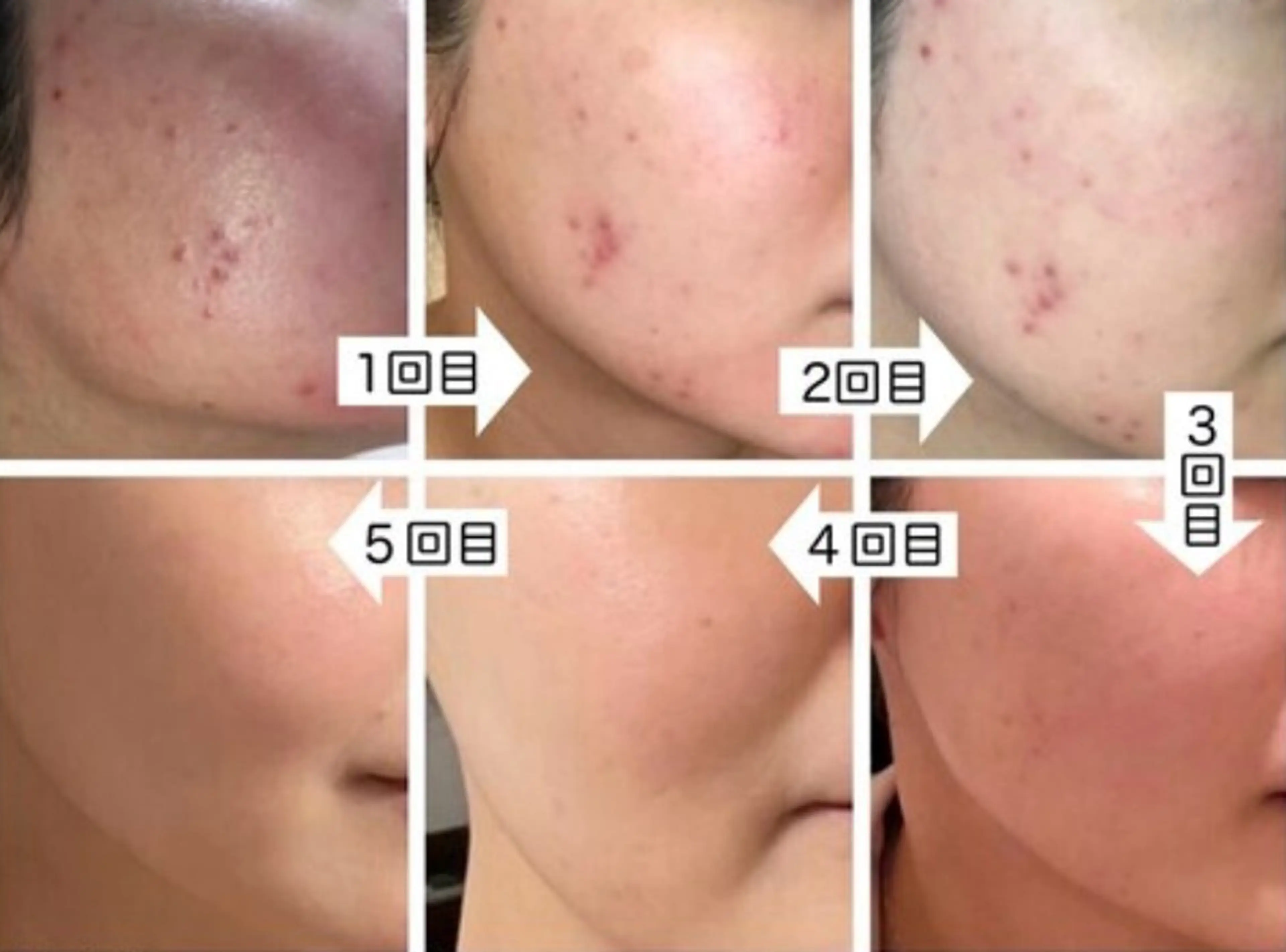 Belle原宿所属・佐藤 加奈のエステ・リラクイメージ