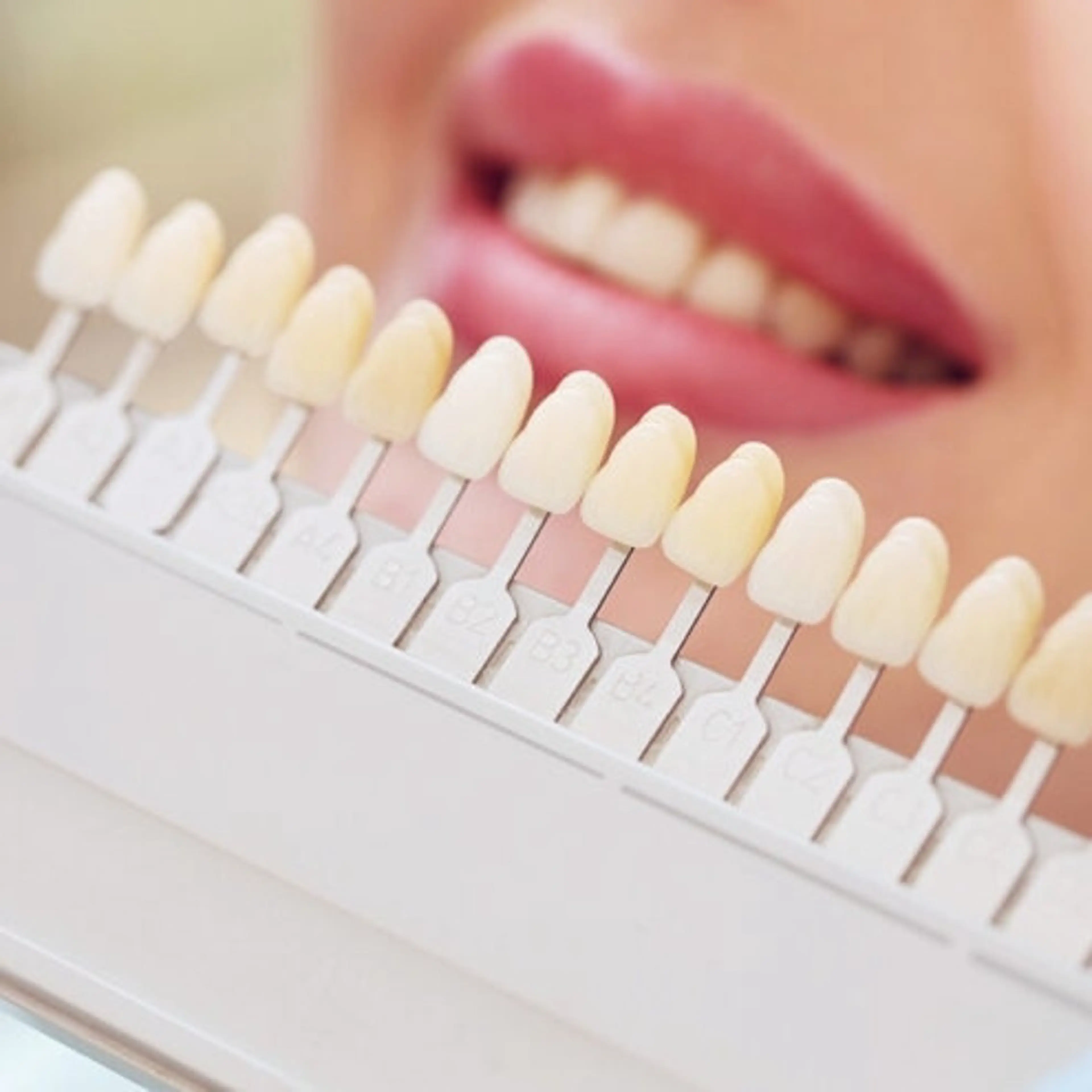 【ﾌﾟﾚﾐｱﾑｹｱ予約の方✨】より早く、より白く🎵の写真