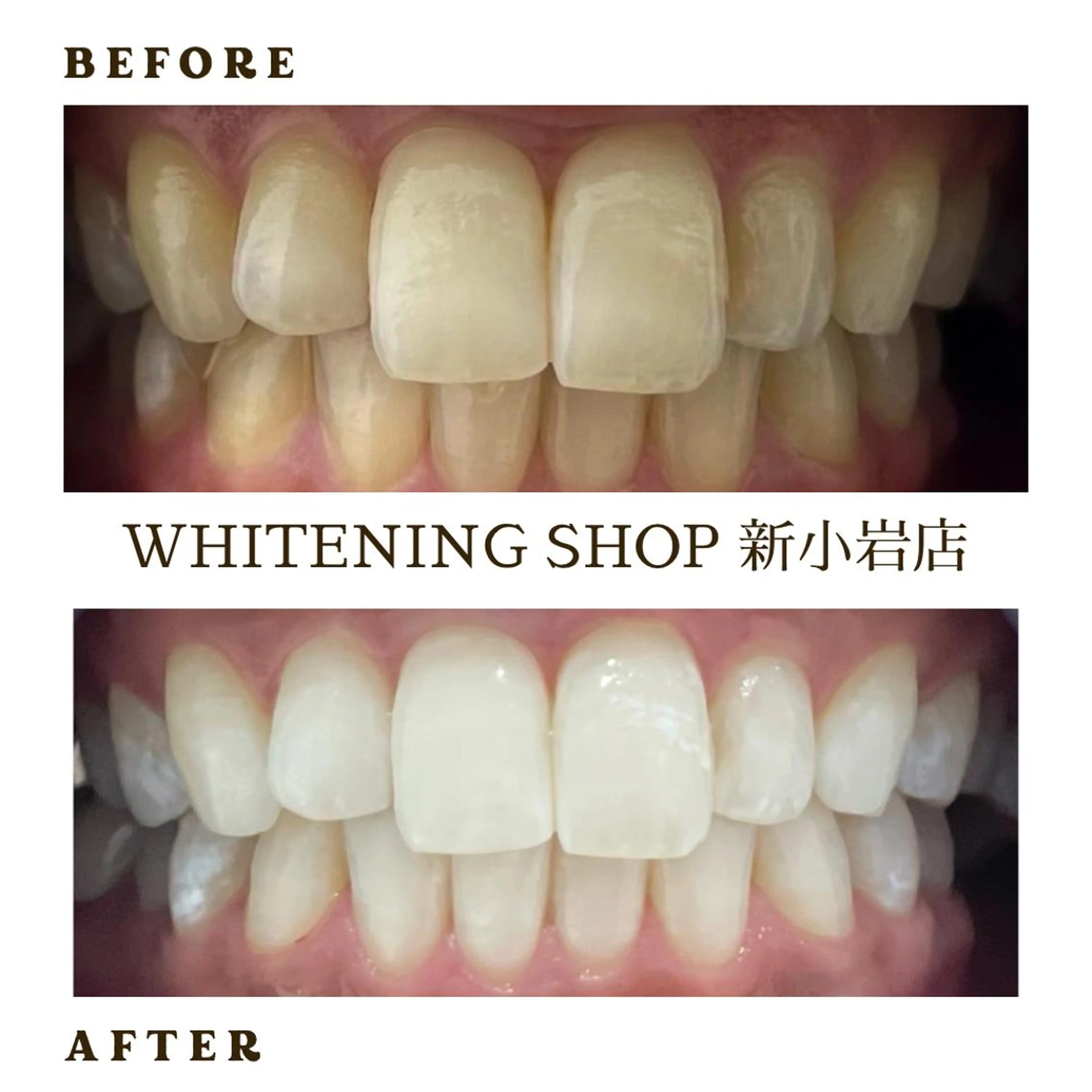 メンズ ホワイトニング ショップ新小岩店のその他イメージ