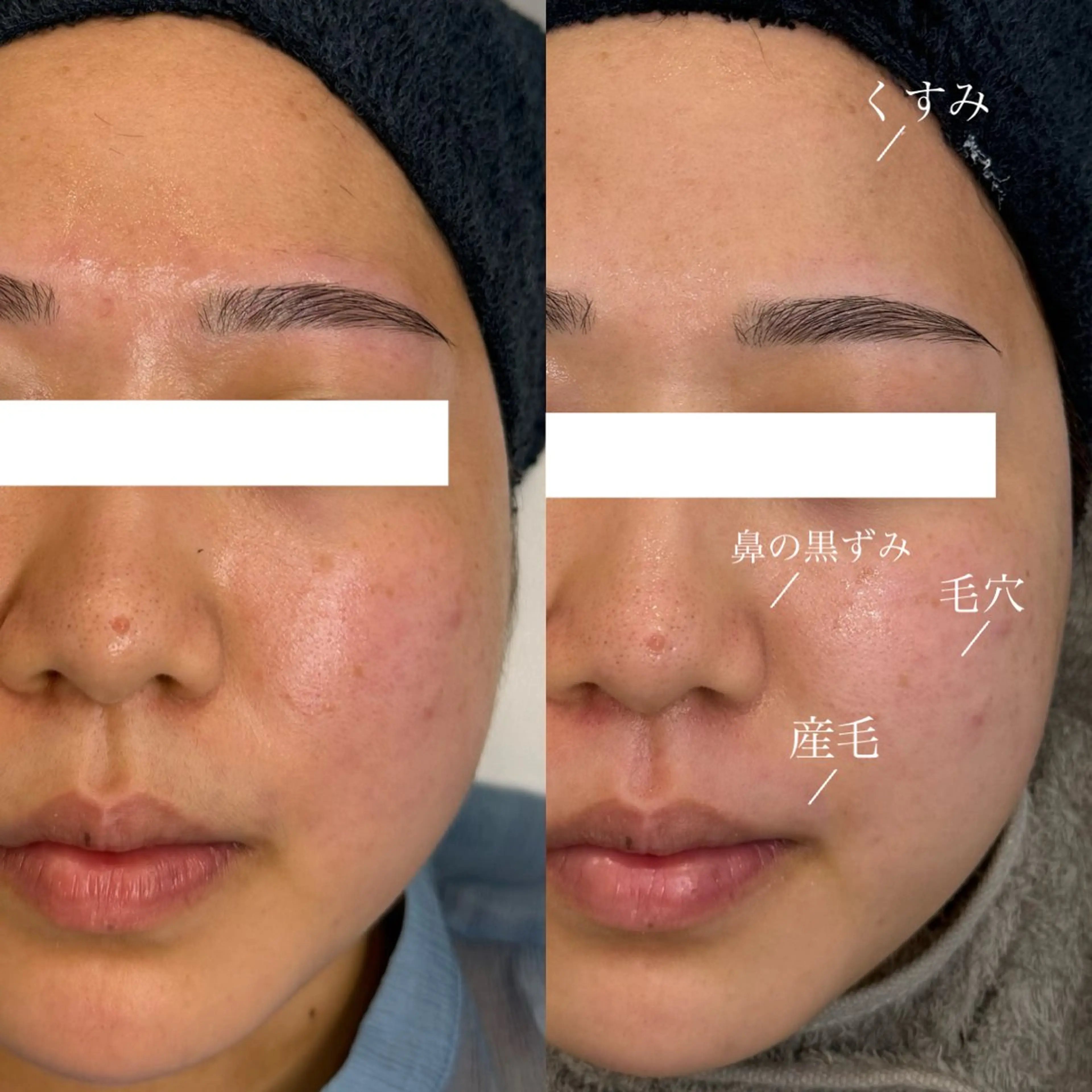 アイブロウ WHITEEYE堺東 店長/藁粥 明の眉毛・アイブロウイメージ