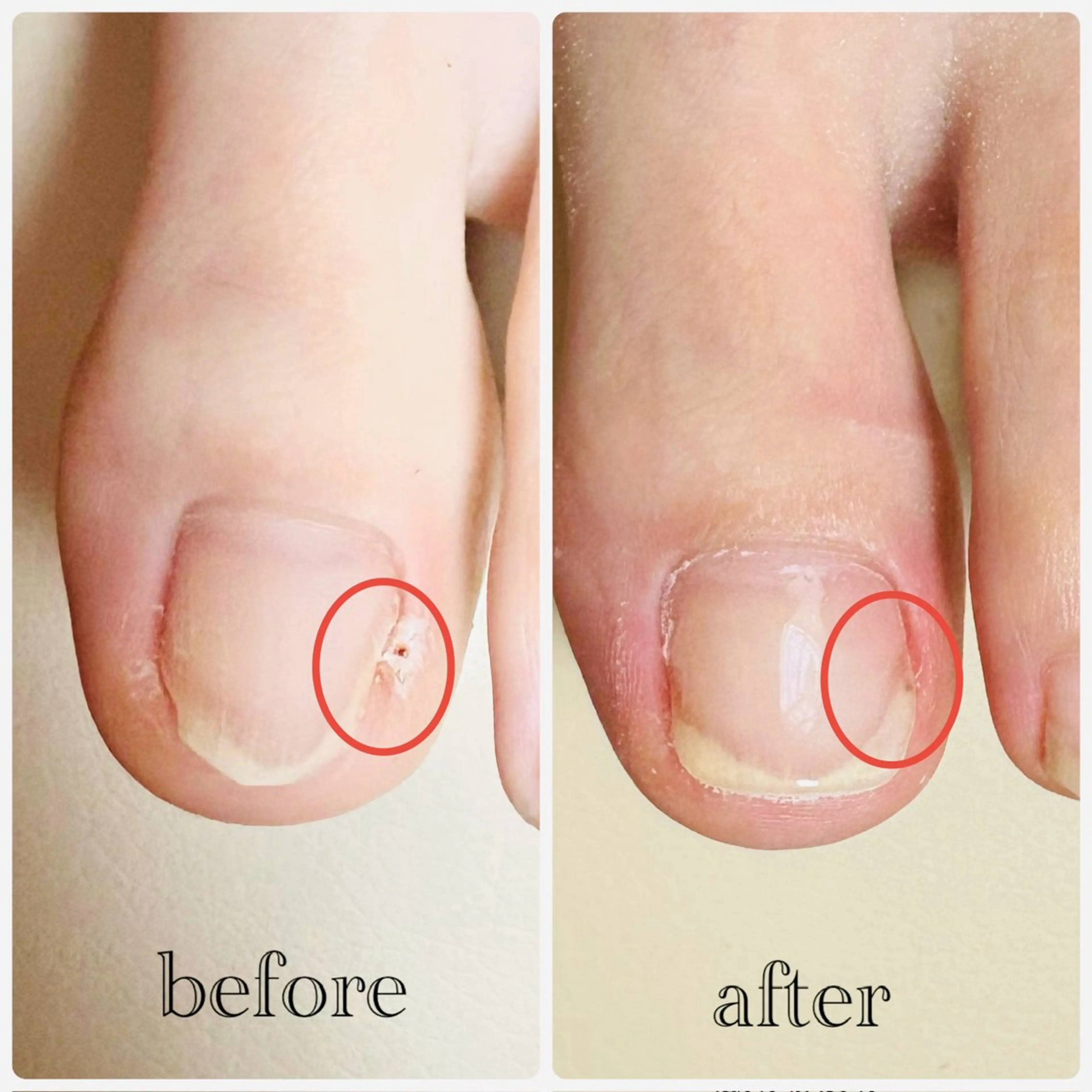 荒井 恵のネイルデザイン