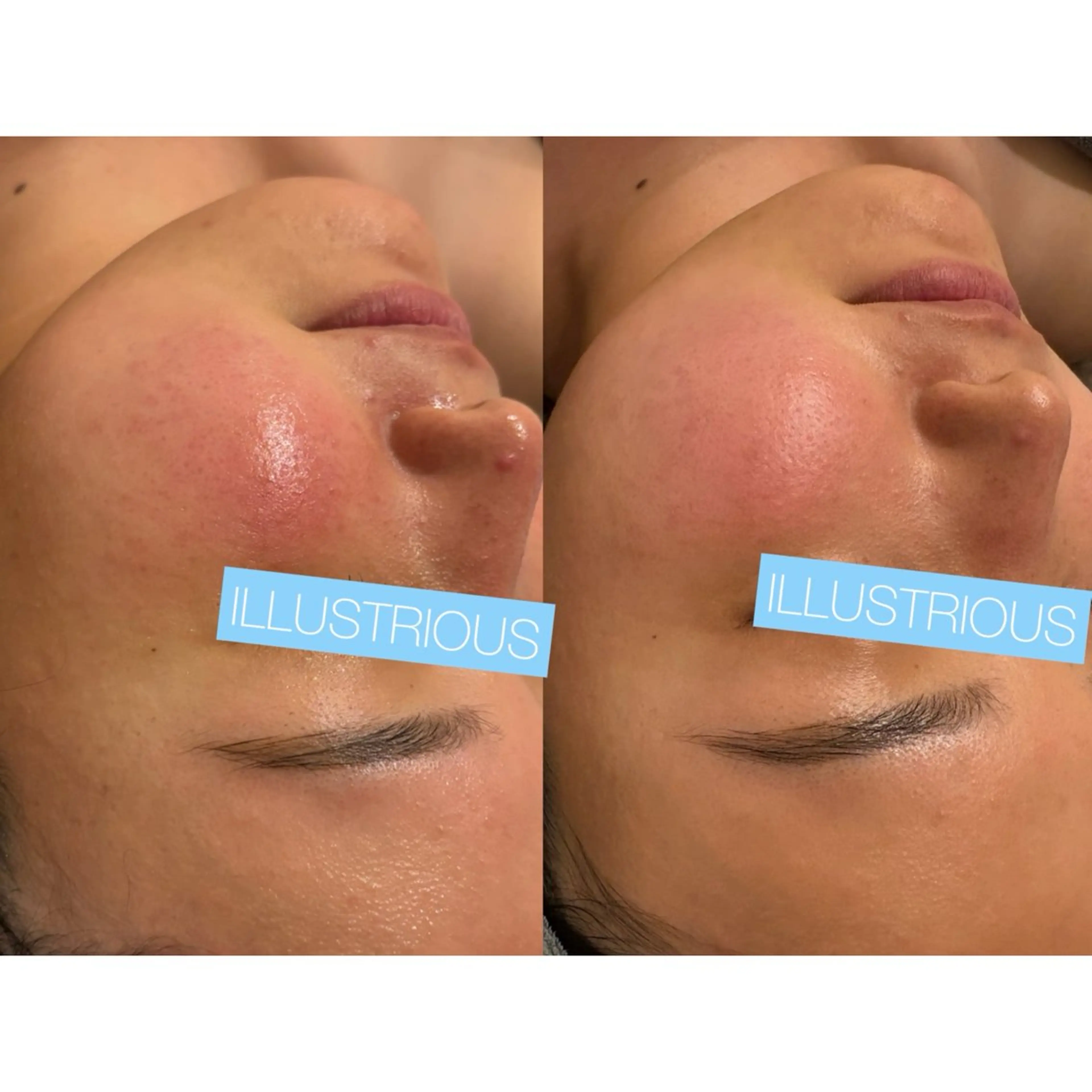 ☆痩身/小顔☆ 結果出します☆のエステ・リラクイメージ