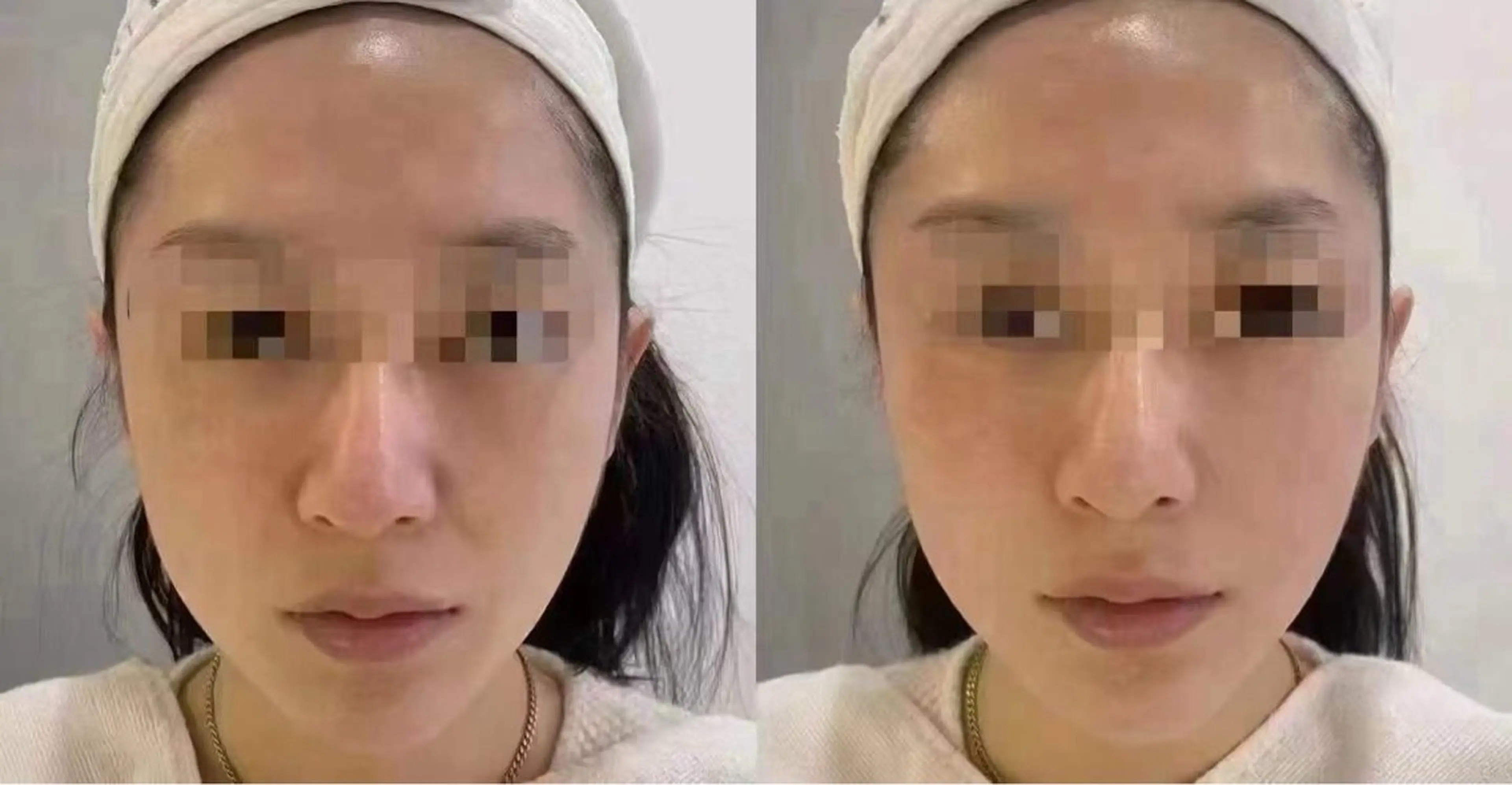 ネイル ブライダルネイル ホワイト エステ aliaハイフ&水光ジェットサロン所属・aliaハーブ水光店 エステティシャン募集のエステ・リラクイメージ