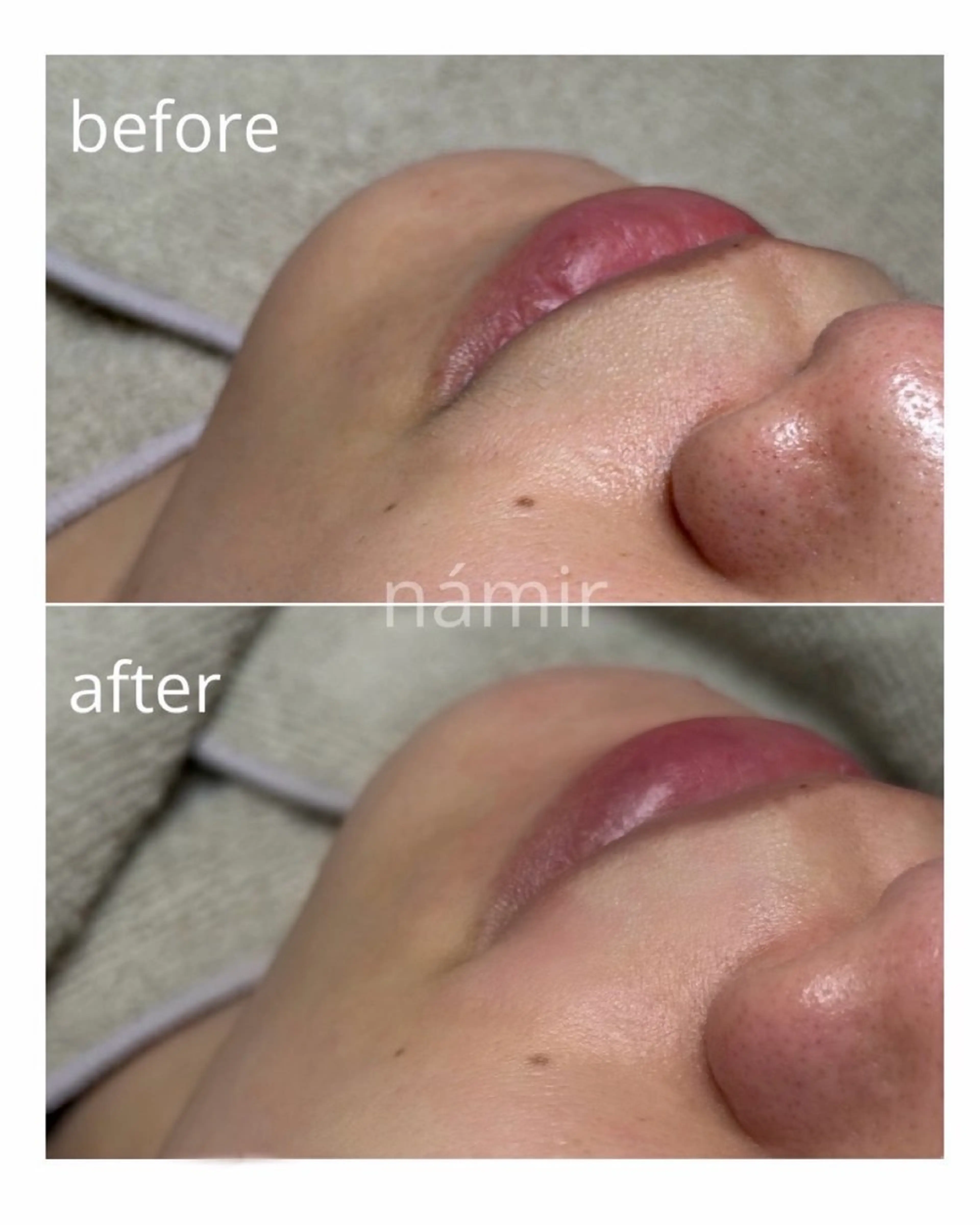 ブラジリアンワックス＋光脱毛専門店námir【ナミル】所属・ブラジリアンワックス ＆光脱毛námirのエステ・リラクイメージ