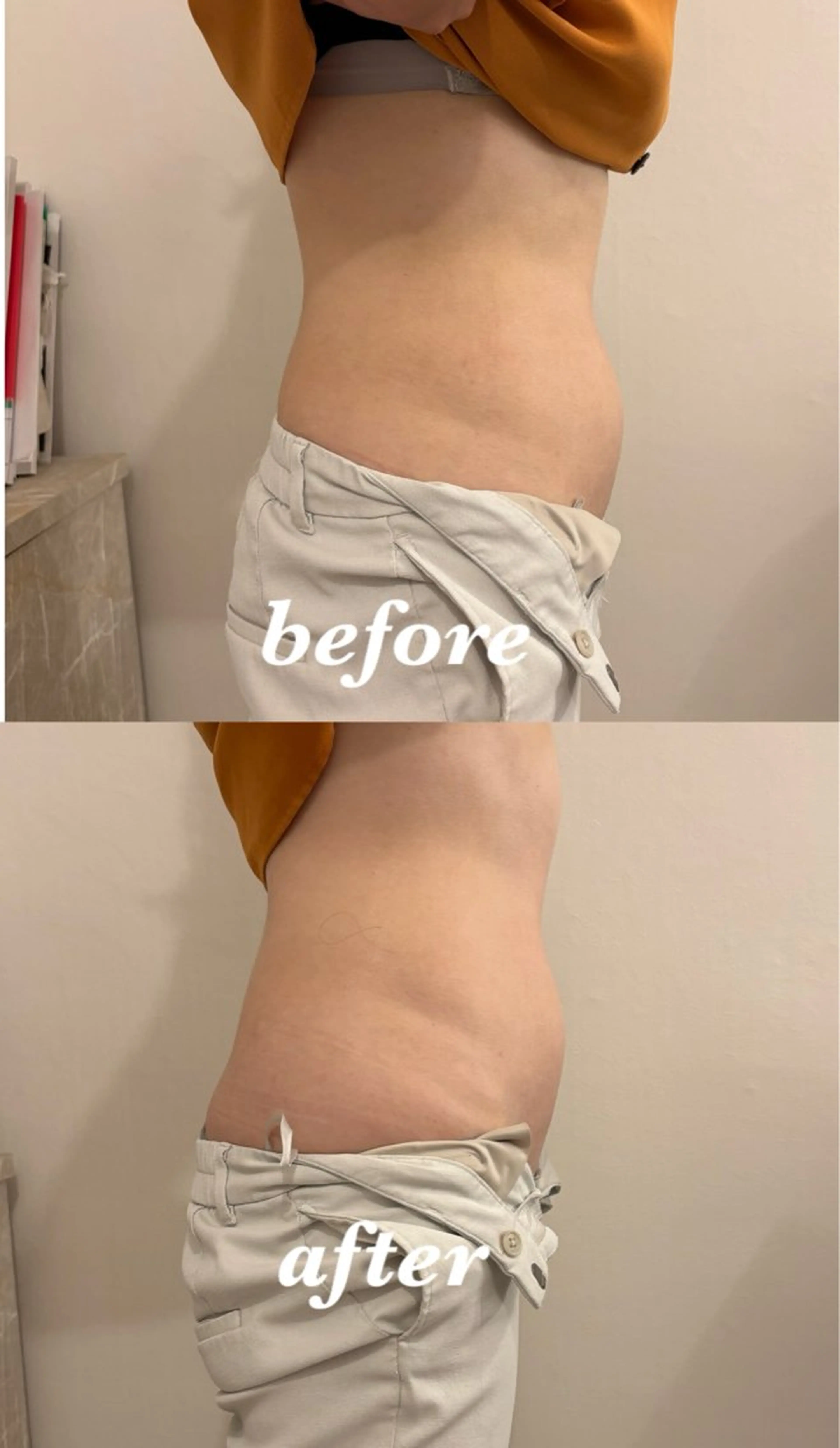 メンズ その他 腸活サポート みなみののエステ・リラクイメージ