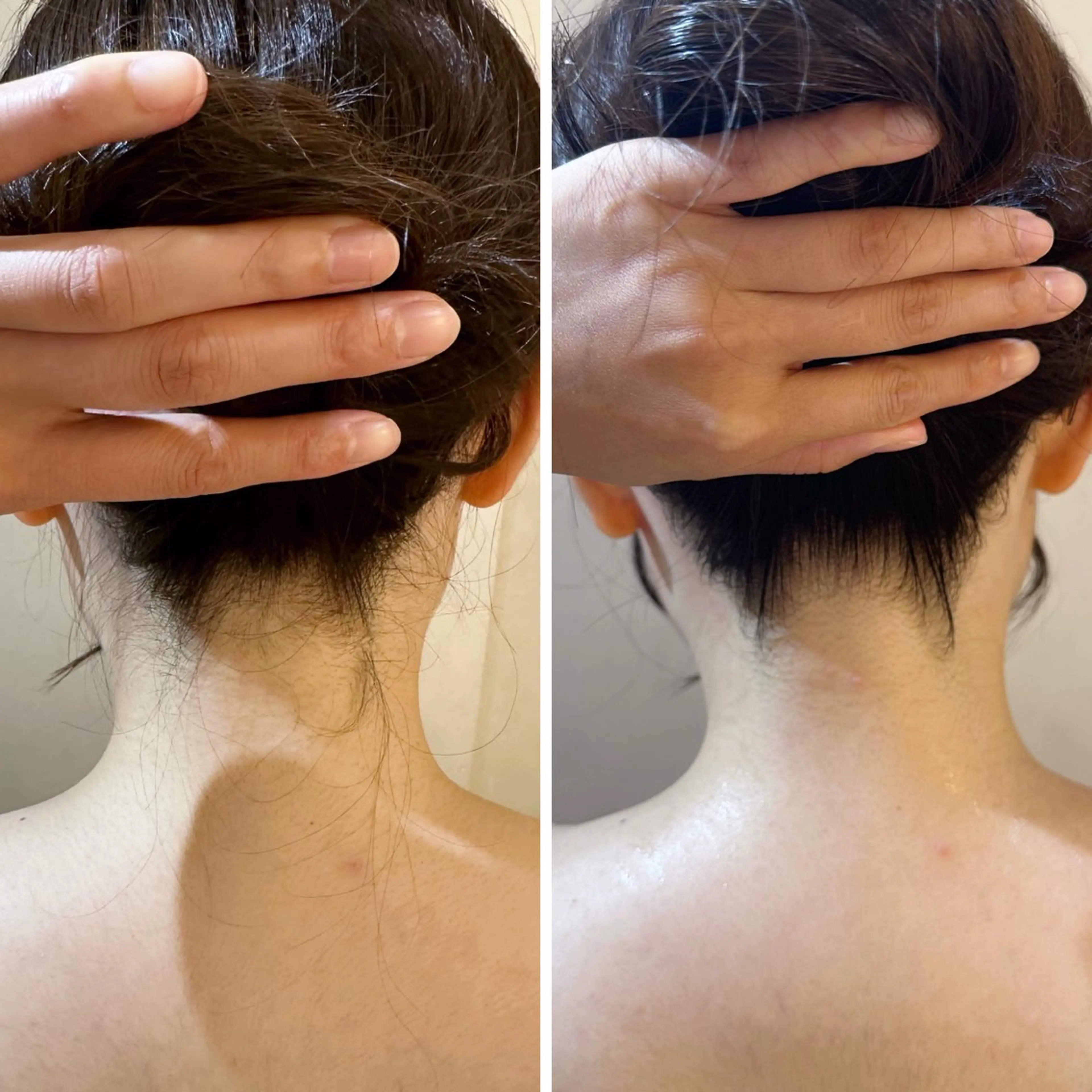 脱毛 うなじ脱毛/美肌脱毛 LABELのエステ・リラクイメージ