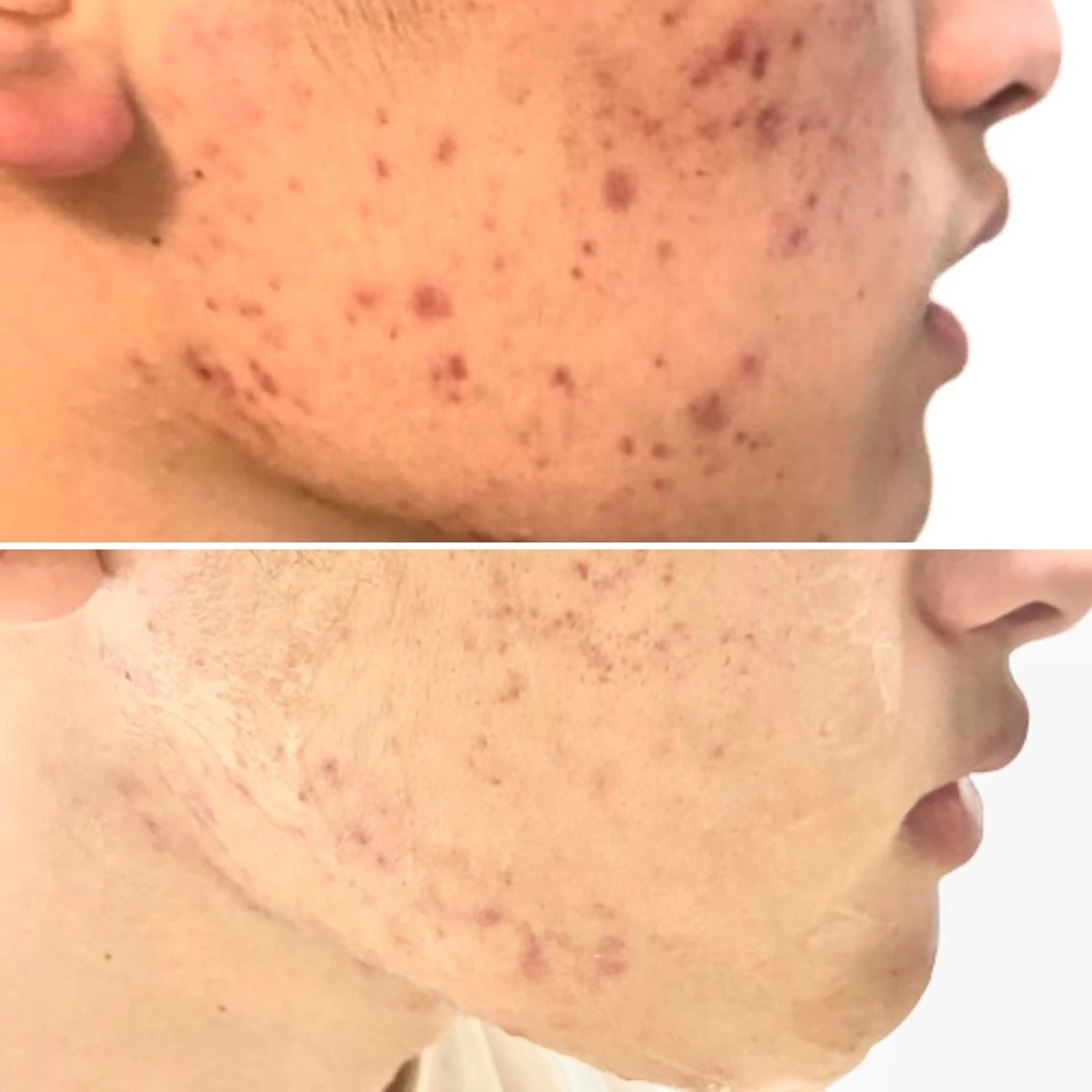 アイブロウ Epina 千葉店 【エピナ】のエステ・リラクイメージ