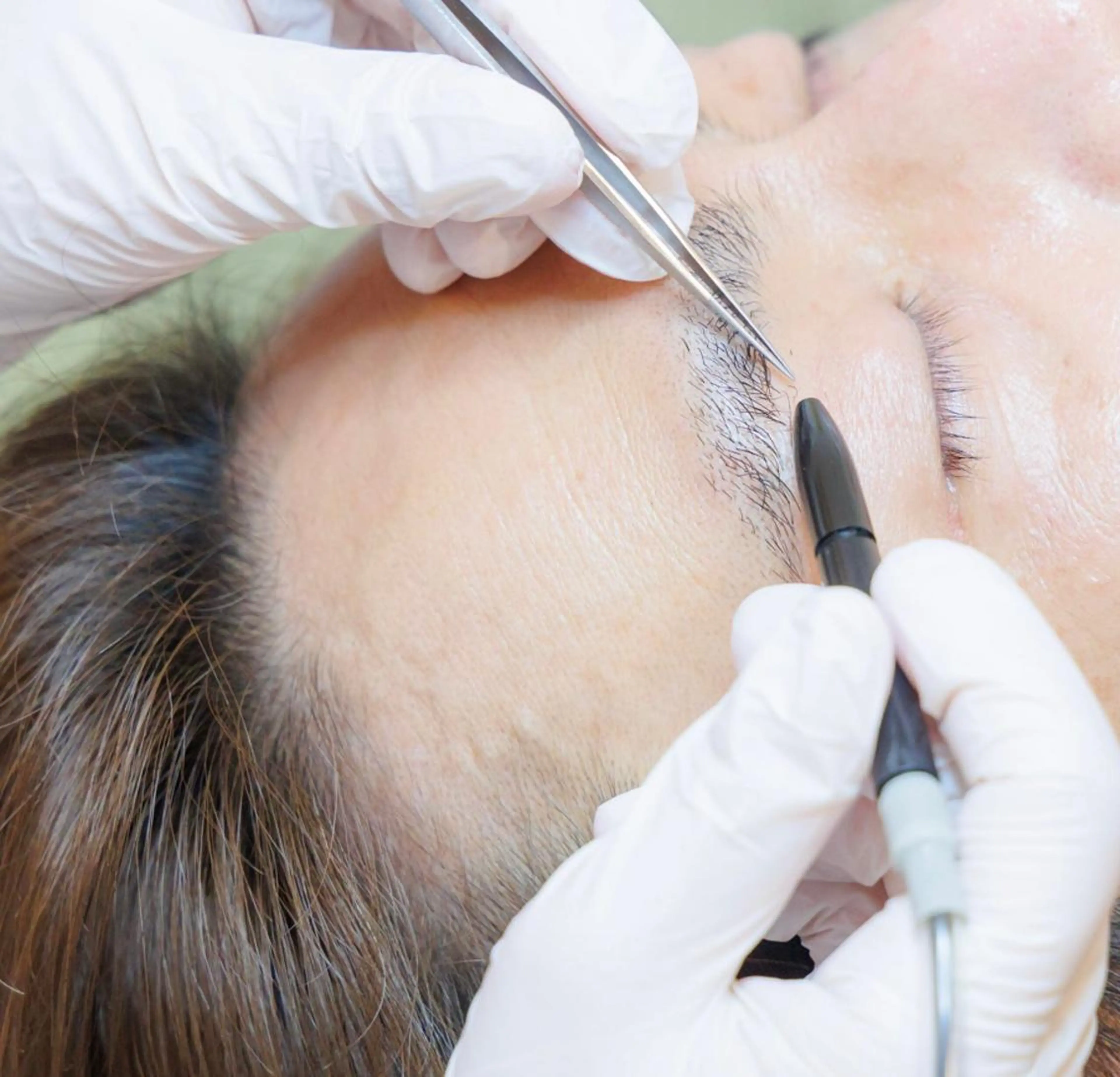 美容電気脱毛　一本一本確実に脱毛【フラッシュ法、スーパーフラッシュ法】30分　✨男性VIO可能✨の写真