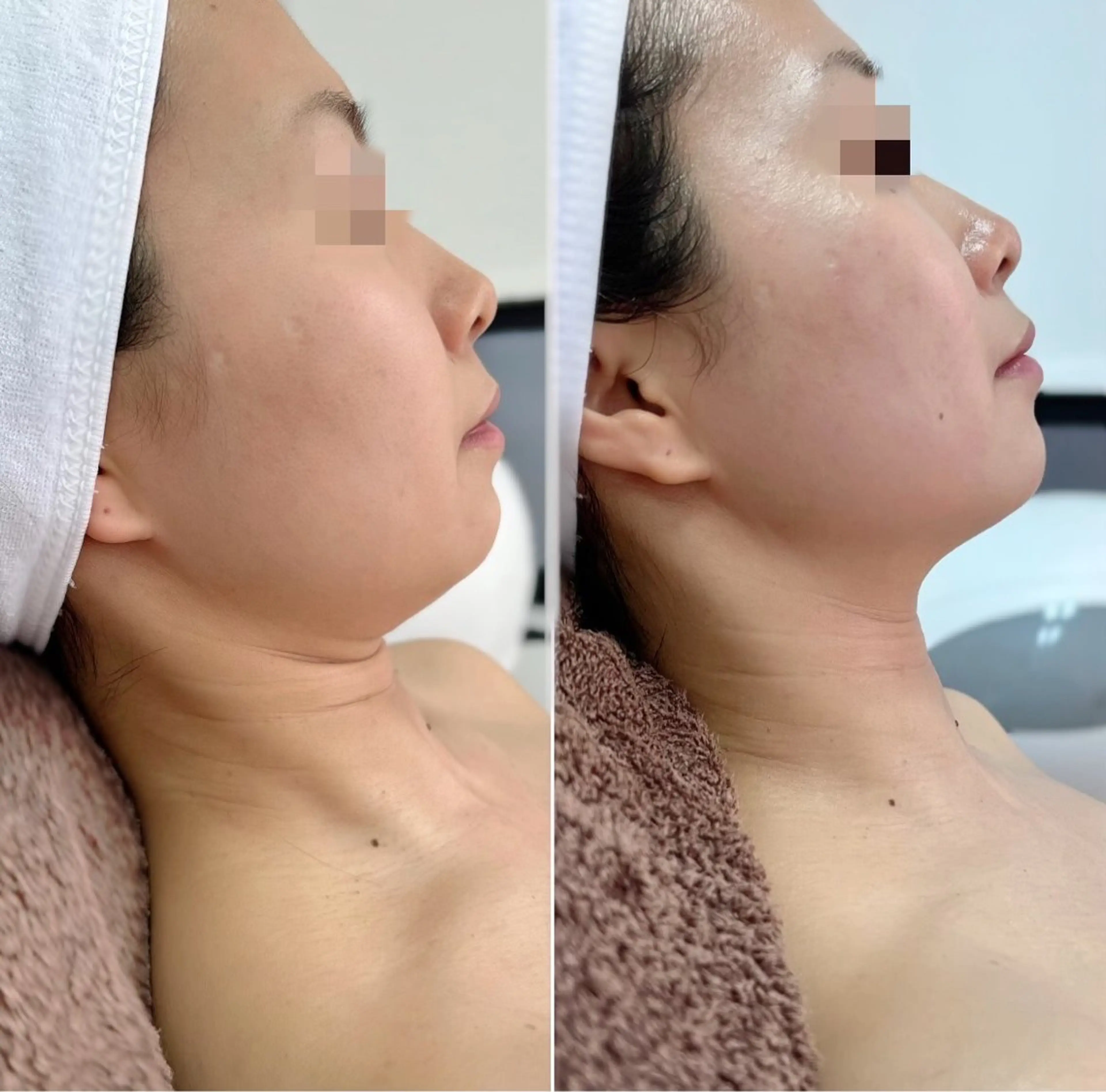 アイラッシュ＆フェイシャルサロン　ベアトリーチェ所属・医療提携美容サロン Beatriceのエステ・リラクイメージ