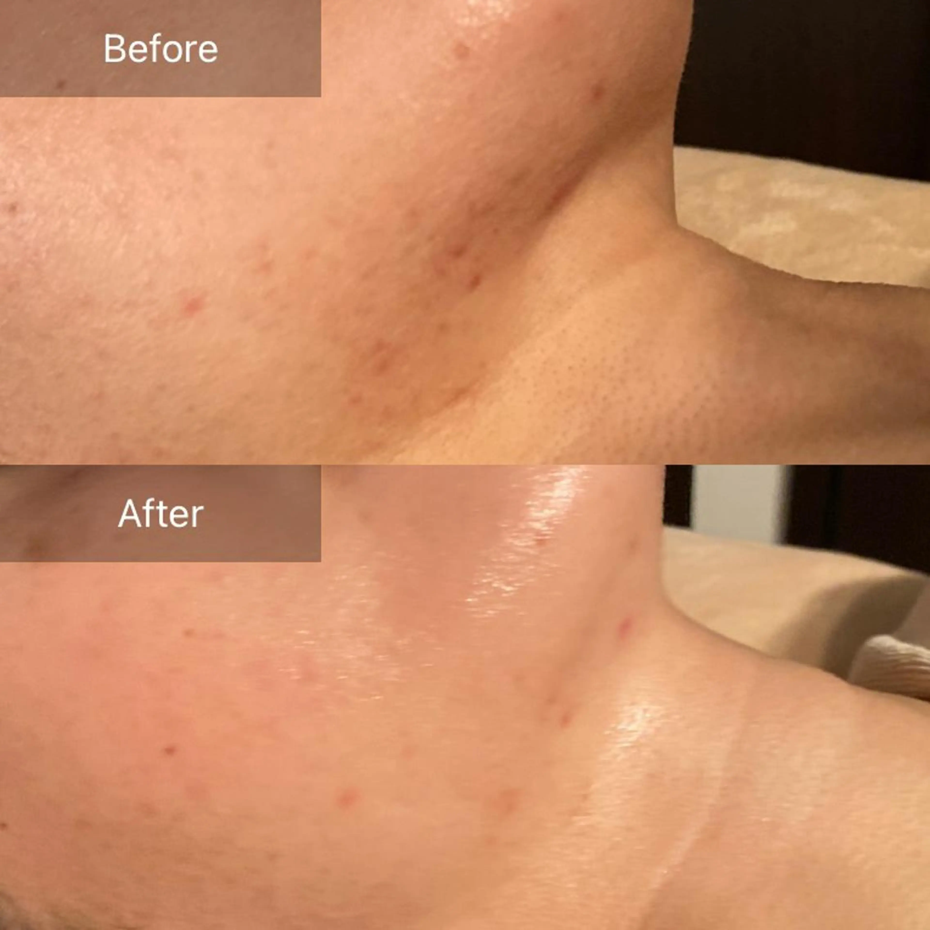 Mandarin Orange所属・毛穴から始める肌メン テマンダリンオレンジのエステ・リラクイメージ