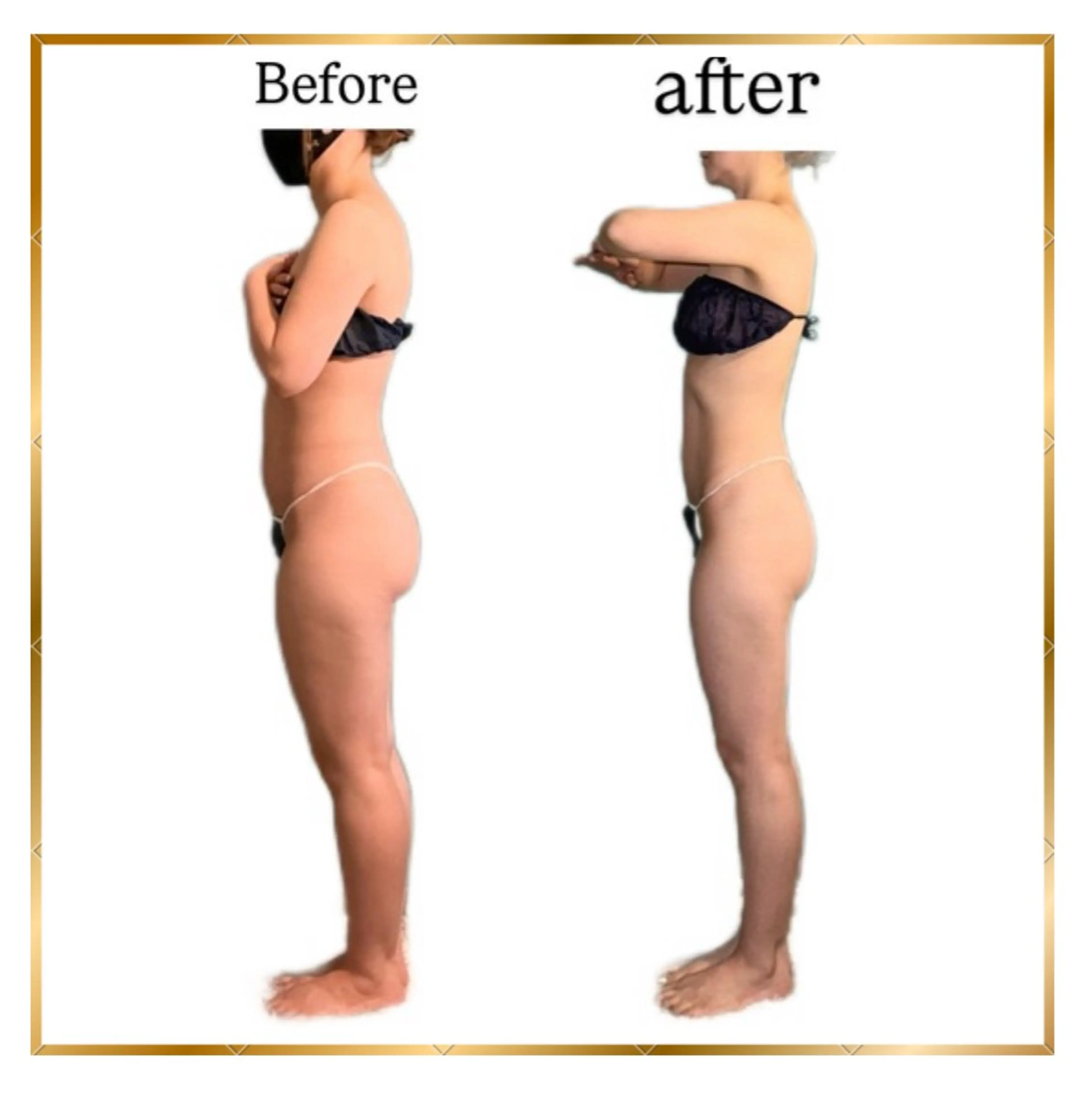 サロン美chill所属・骨格から変える痩身 サロン美chillのエステ・リラクイメージ