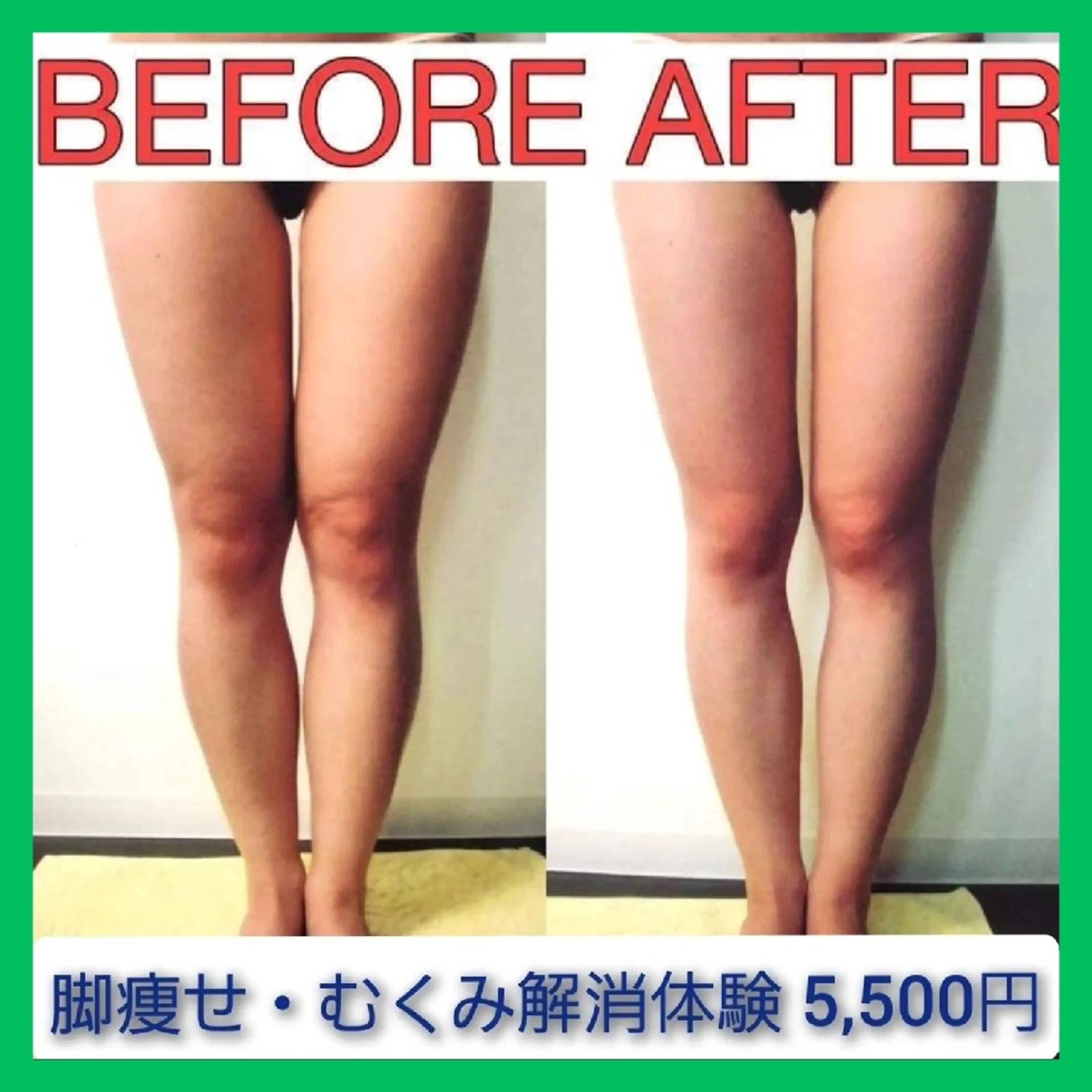 《ダイエット/痩身/下半身痩せ！リラクゼーション効果も◎》脚痩せ・むくみ解消1回体験💎　[大阪城北詰駅/京橋駅]の写真