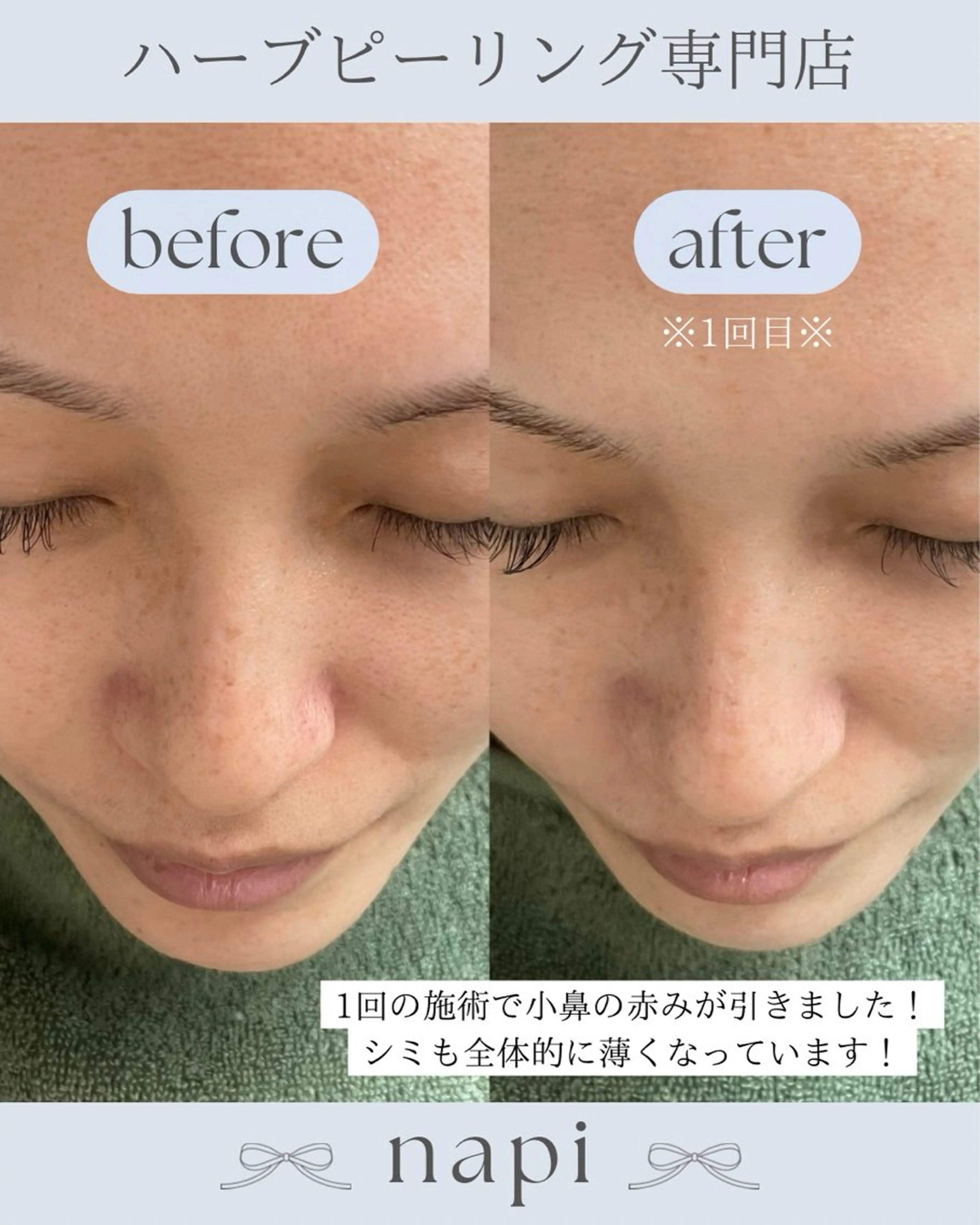 ハーブピーリング 専門店napiのエステ・リラクイメージ