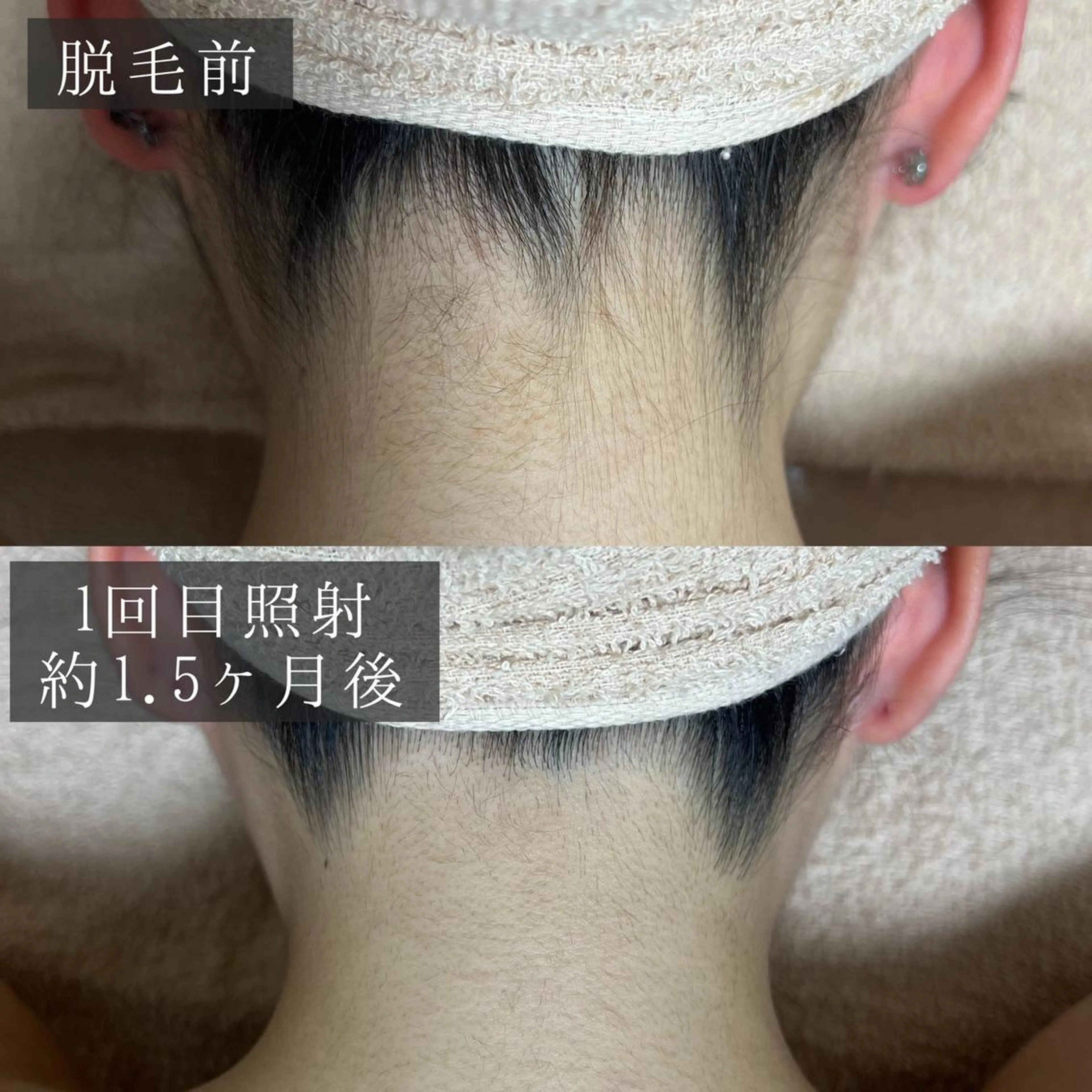 脱毛 脱毛専門サロン BELFINE恵比寿のエステ・リラクイメージ