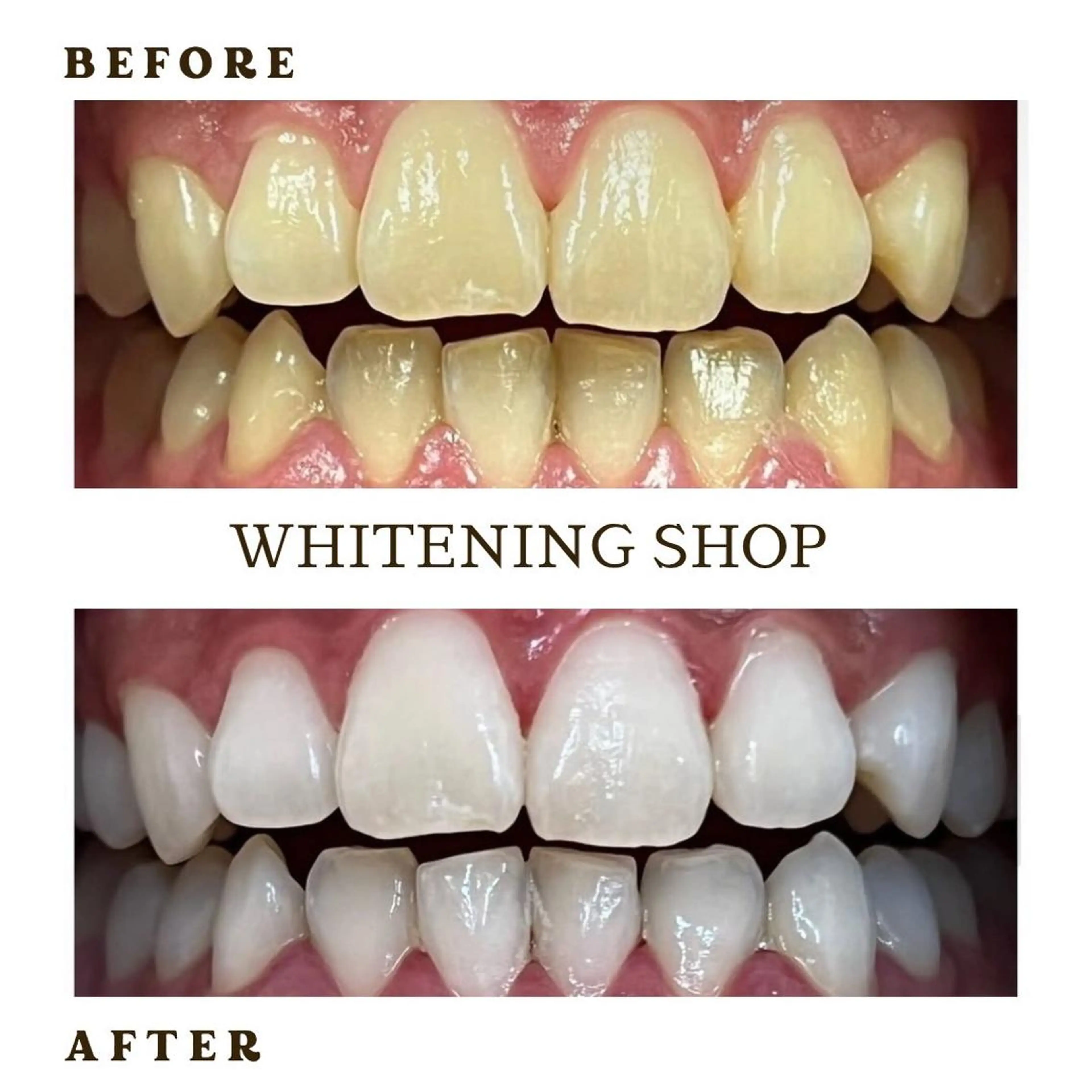 メンズ その他 ホワイトニング ショップ千葉店のその他イメージ