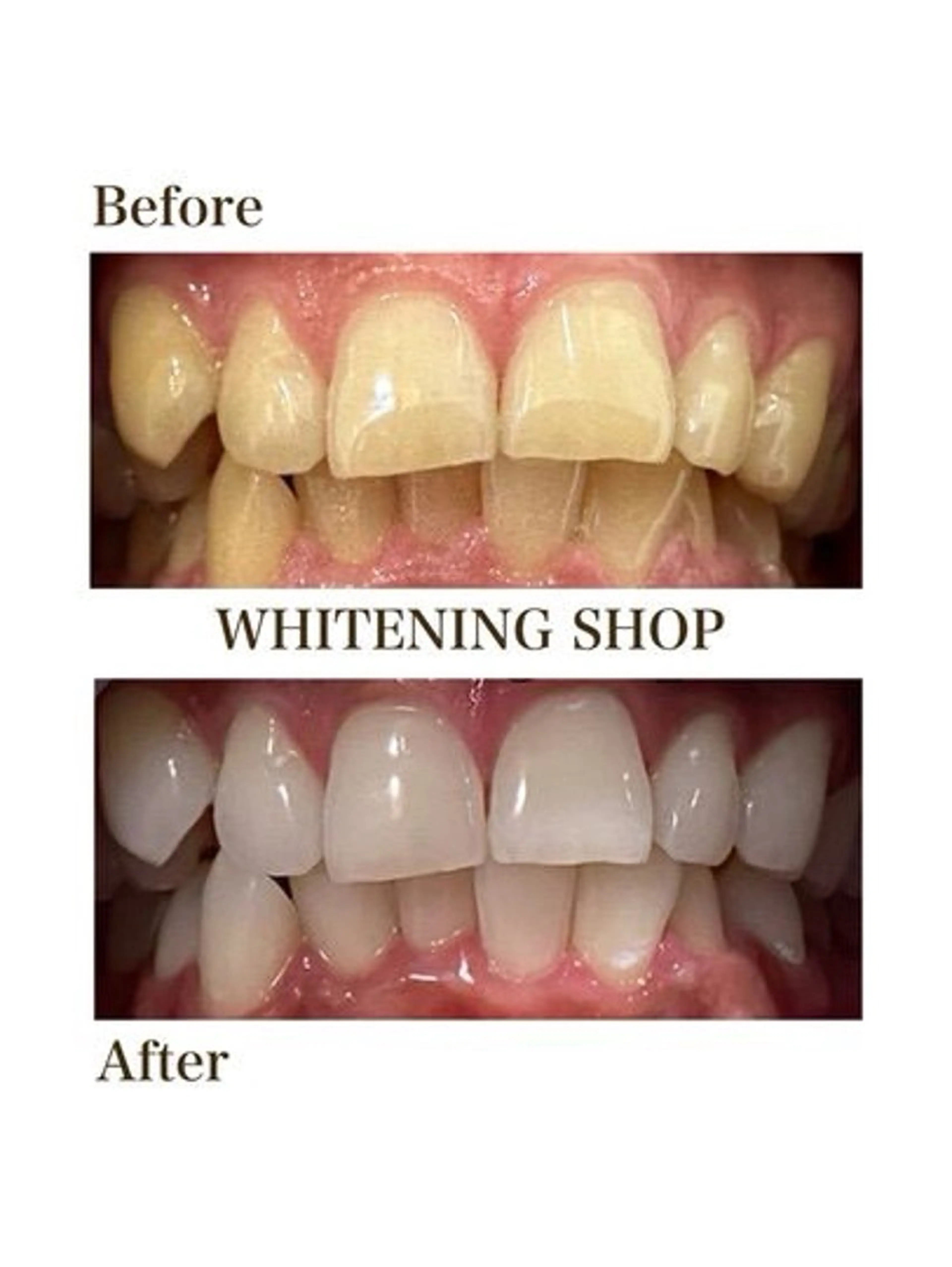 ホワイトニングショップ津店所属・ホワイトニング ショップ津店のその他イメージ