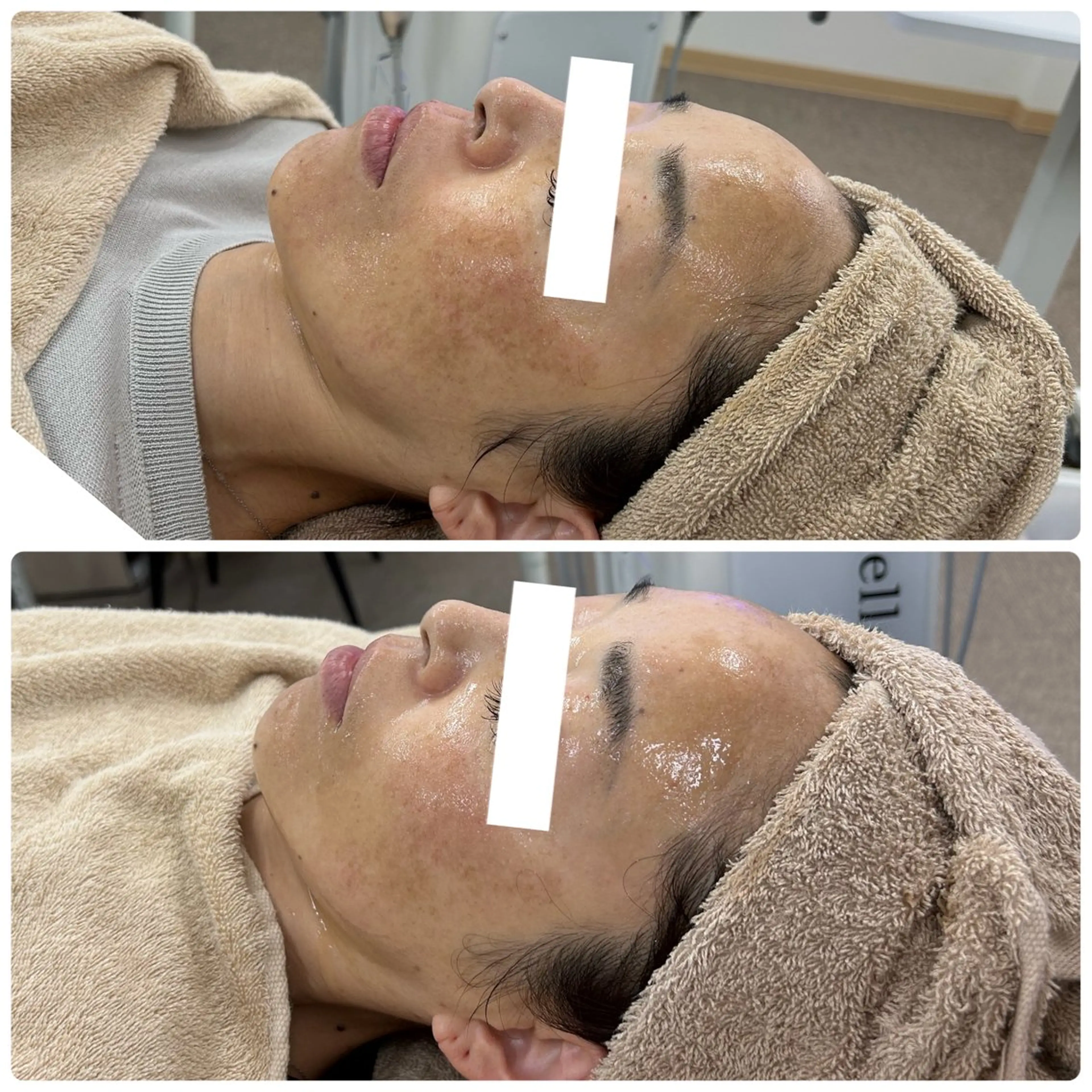 エステ Venus所属・エステサロン Venusのその他イメージ