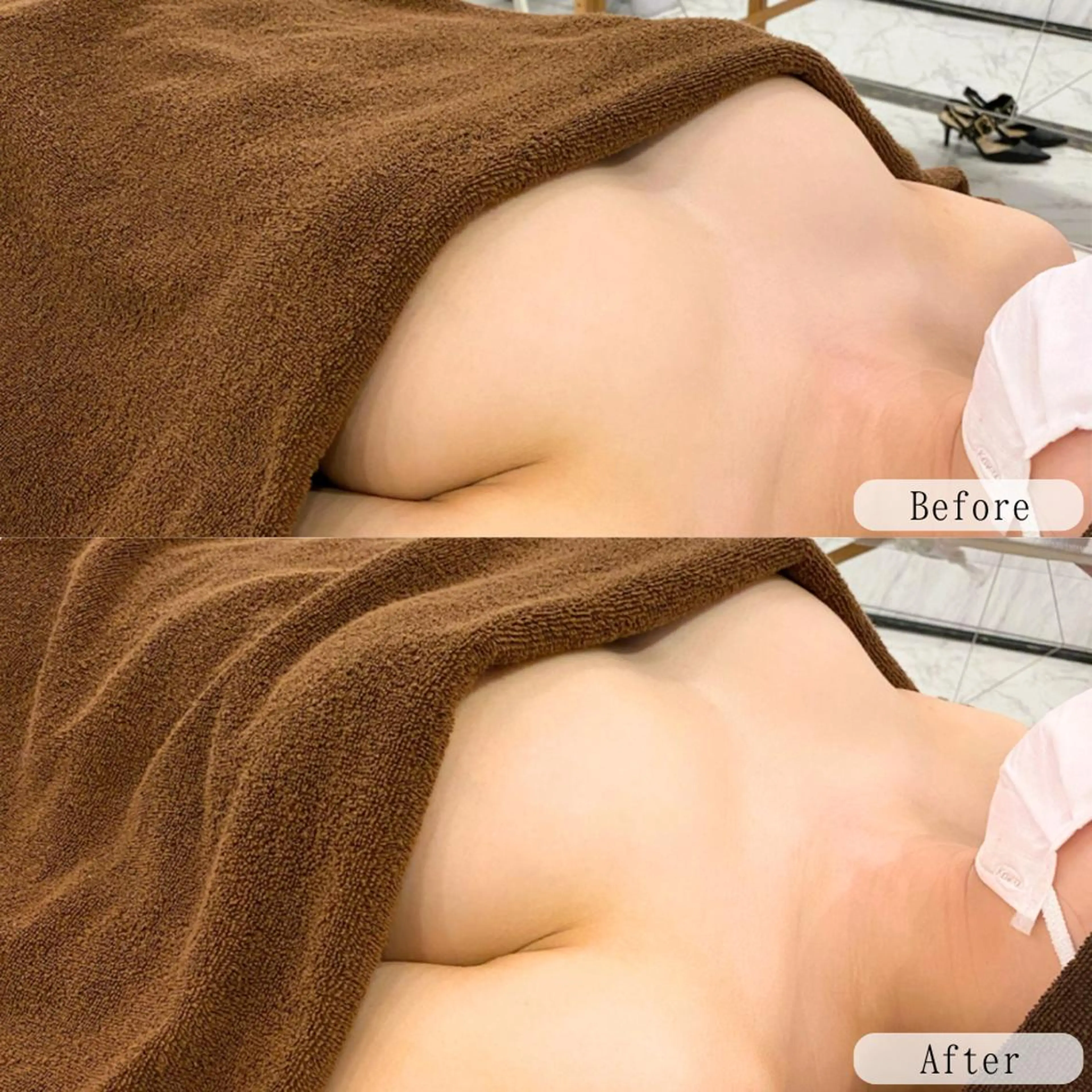 【人気No.2】バスト&姿勢W改善!全身美シルエットケア ¥27,000→¥10,800の写真