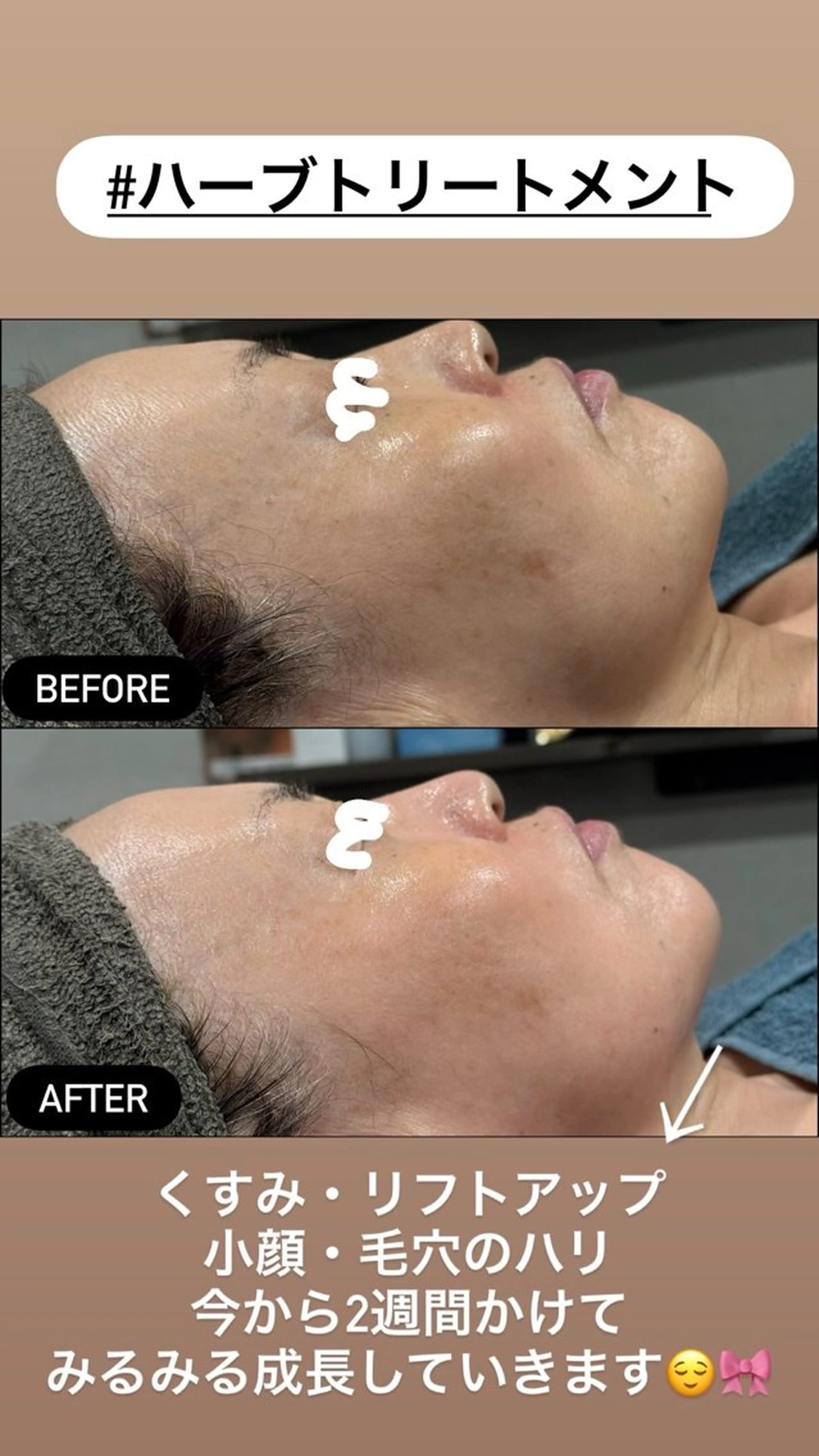 エステ LiZA エステティックサロンのエステ・リラクイメージ