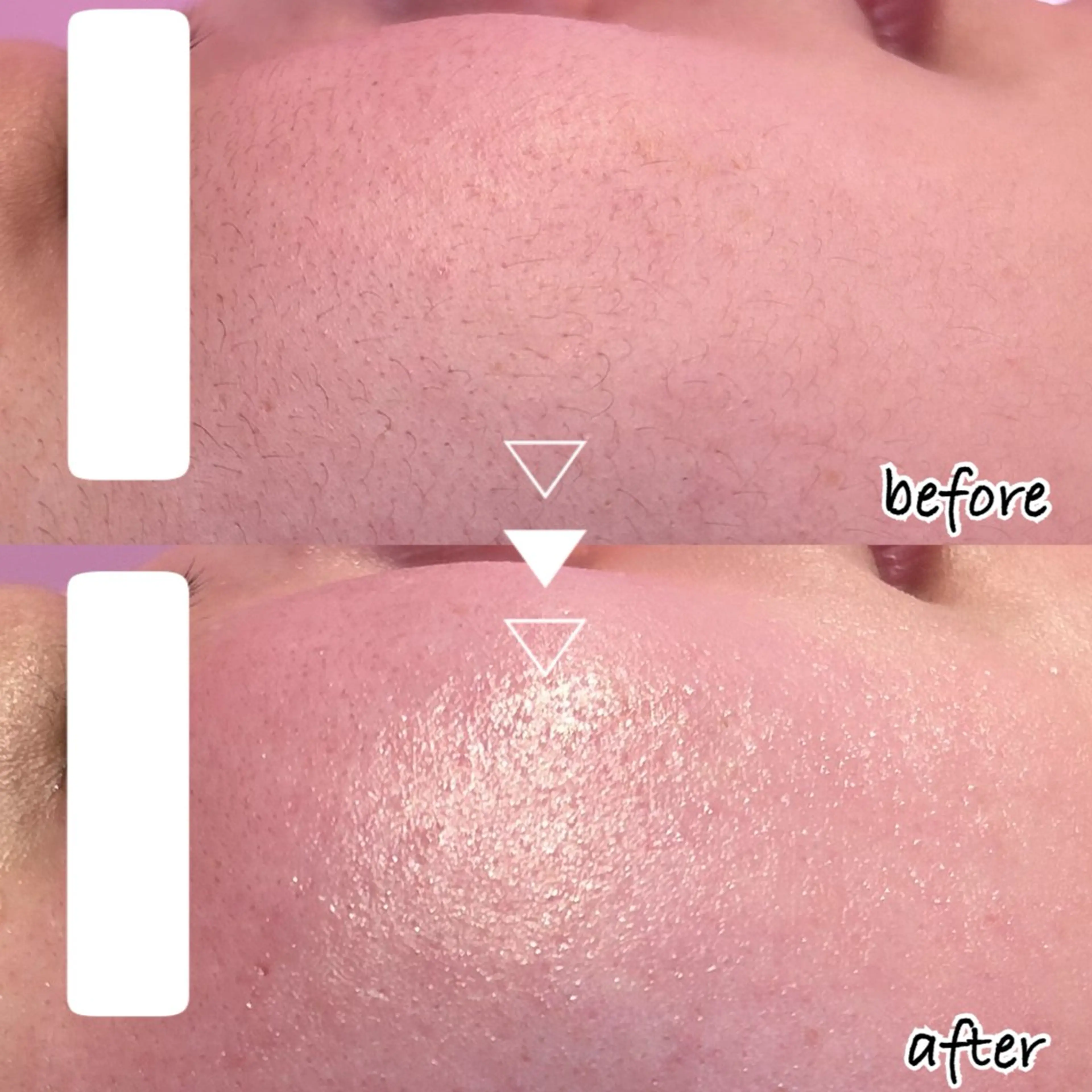 脱毛 韓国肌管理専門店　White labo 新潟店所属・韓国肌管理専門店 Rihoのエステ・リラクイメージ