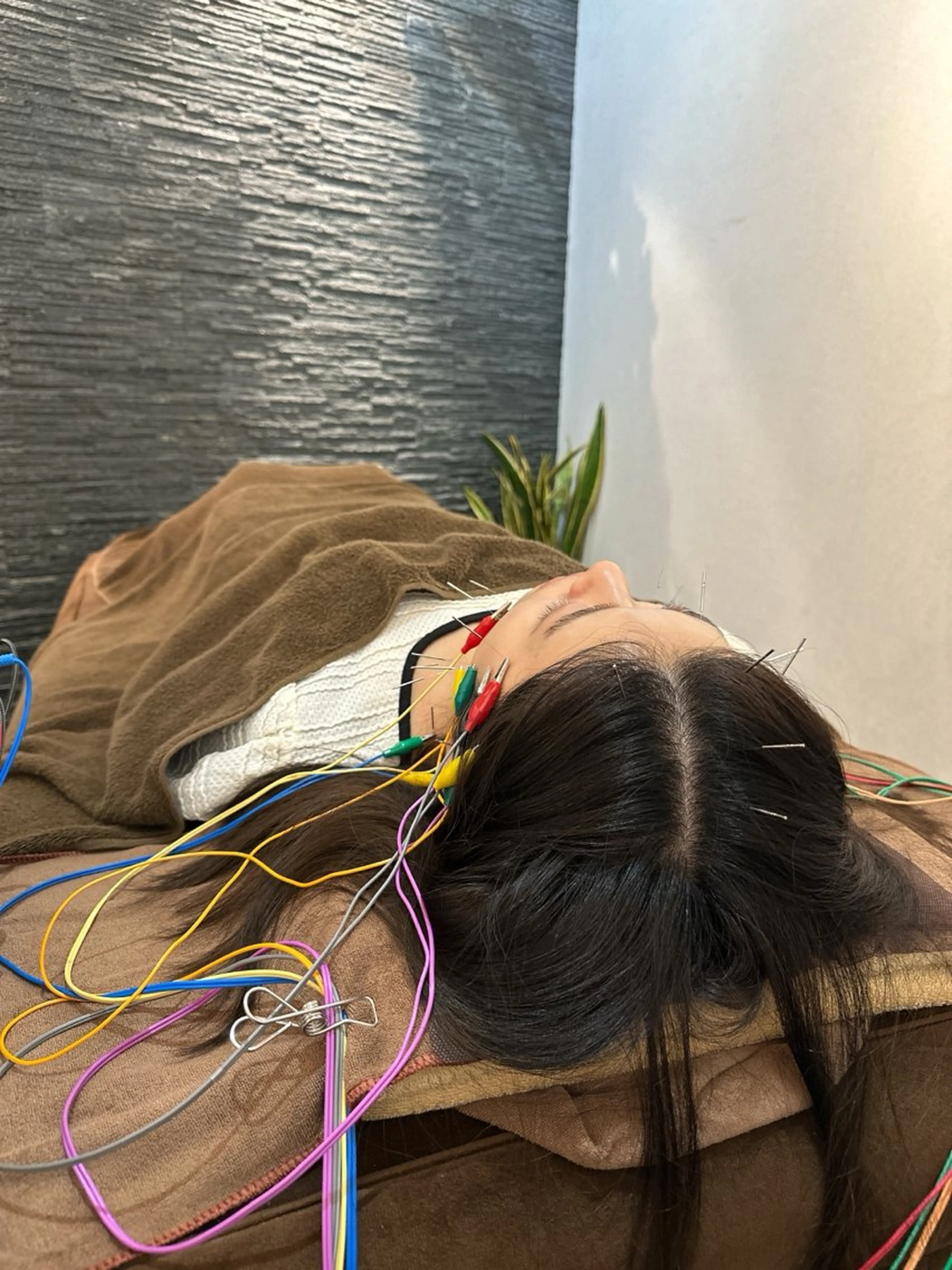 その他 美容鍼灸整体サロンBeauJu所属・小顔矯/美容鍼/鍼灸 BeauJuのその他イメージ