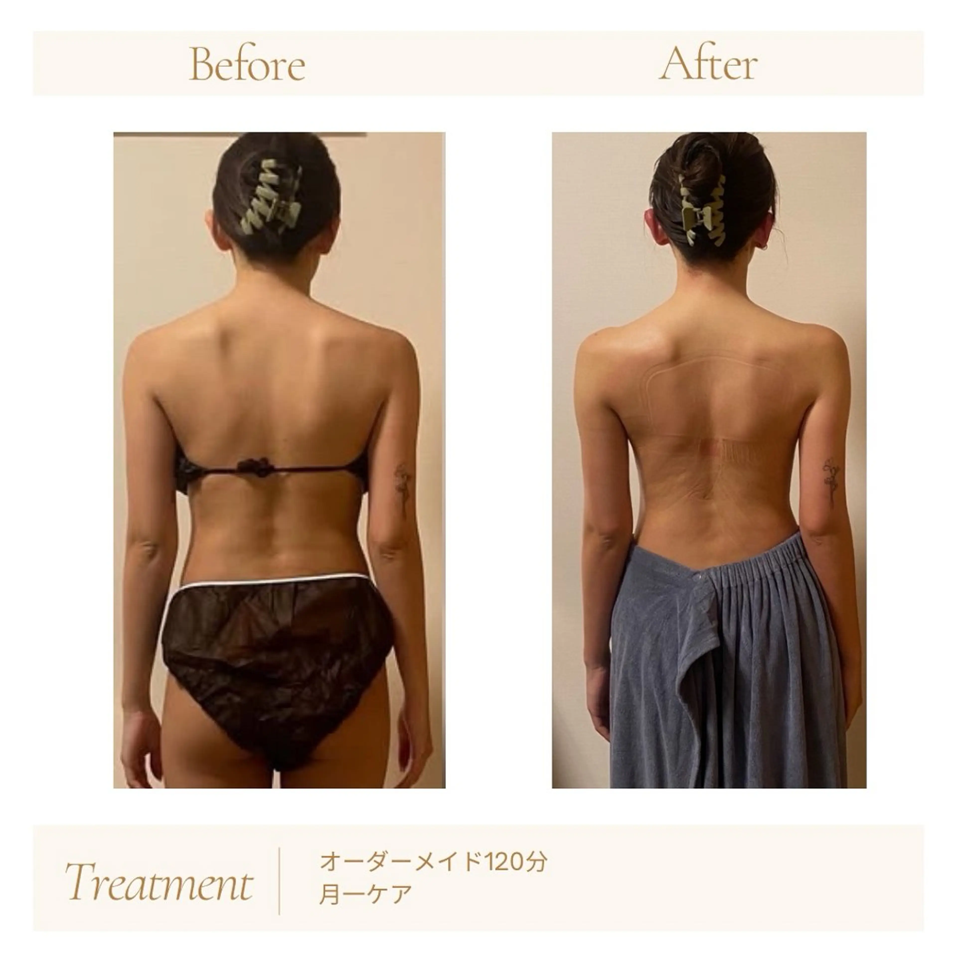 【脳が眠るエレクトロハンドBODY】90分　全身＋脳髄骨コースの写真