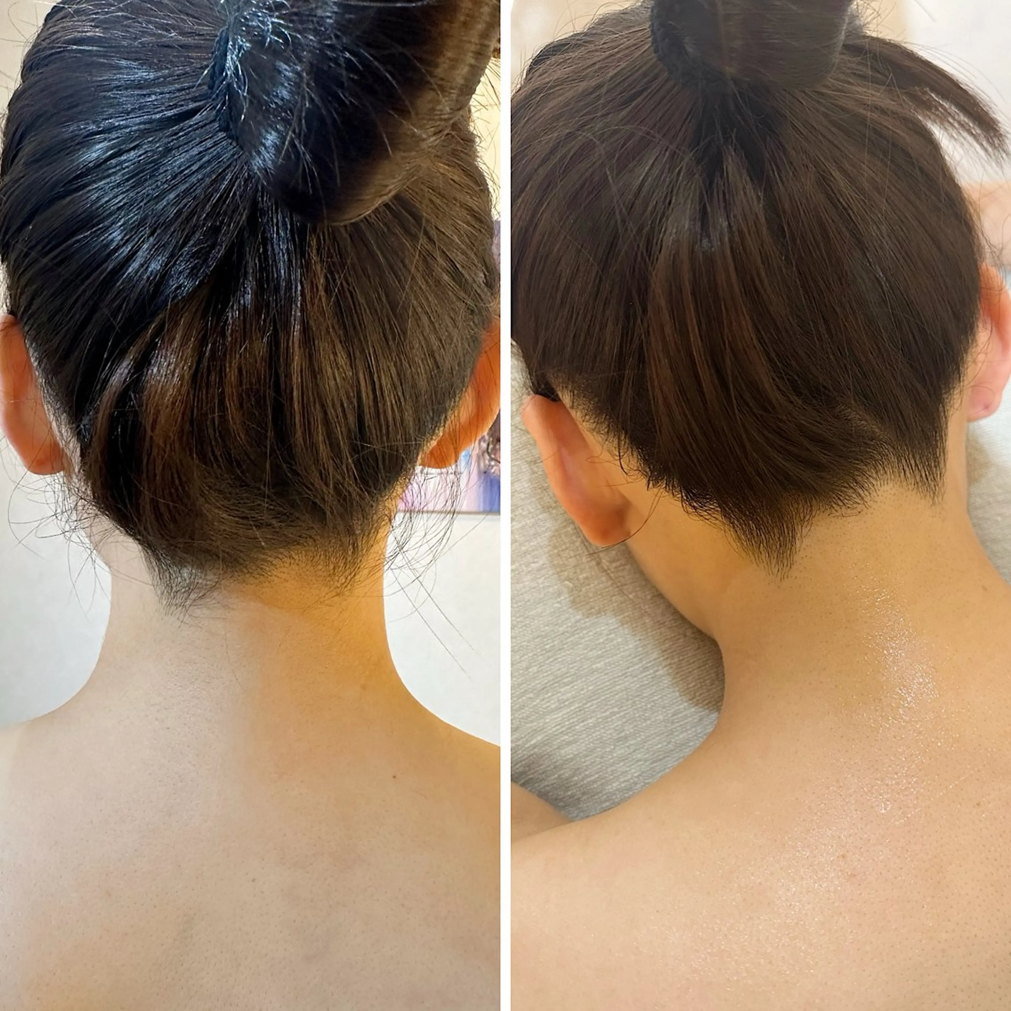 脱毛 うなじ脱毛/美肌脱毛 LABELのエステ・リラクイメージ