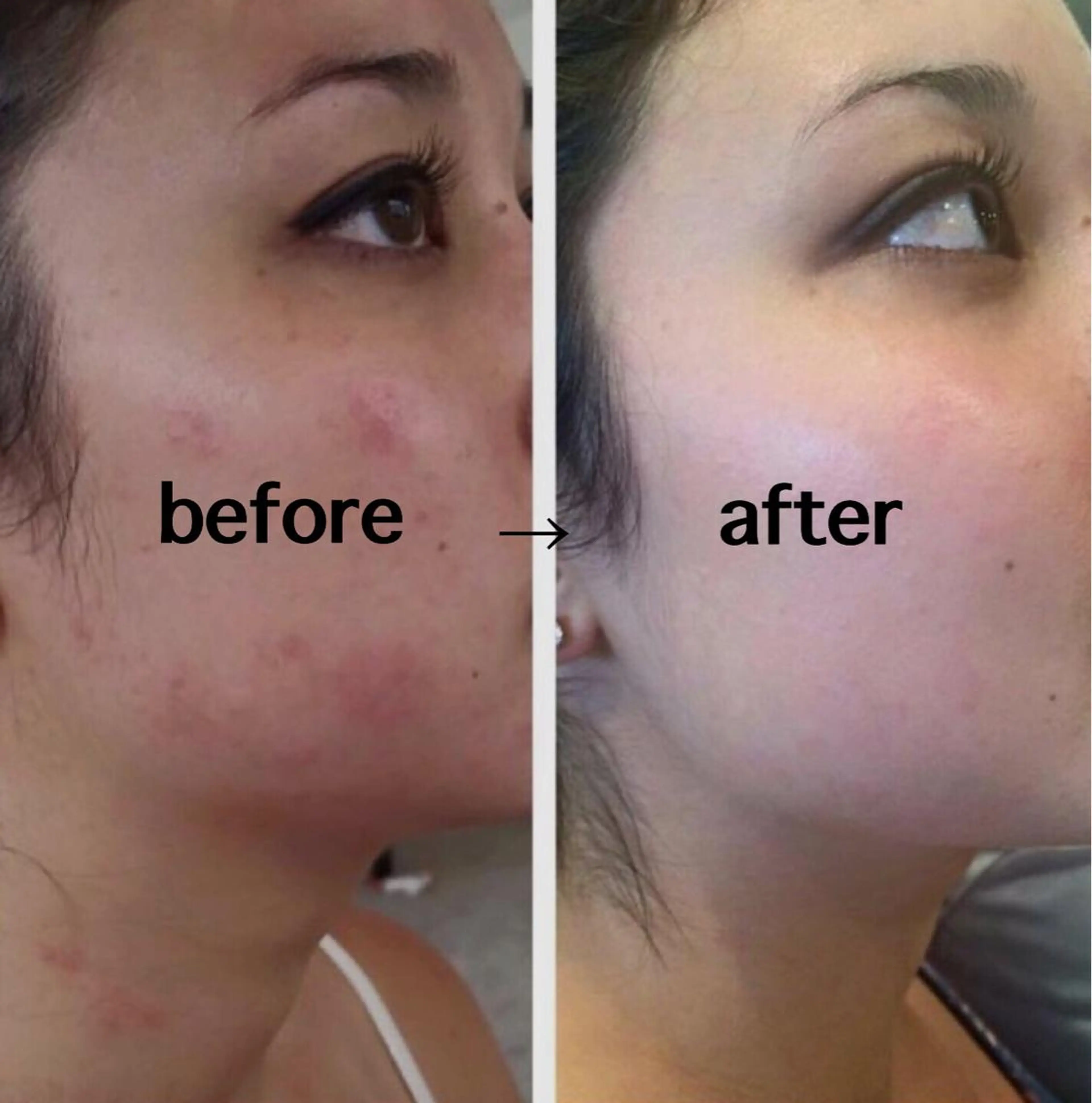 自爪育成ネイルサロン ココリュバンのネイルデザイン