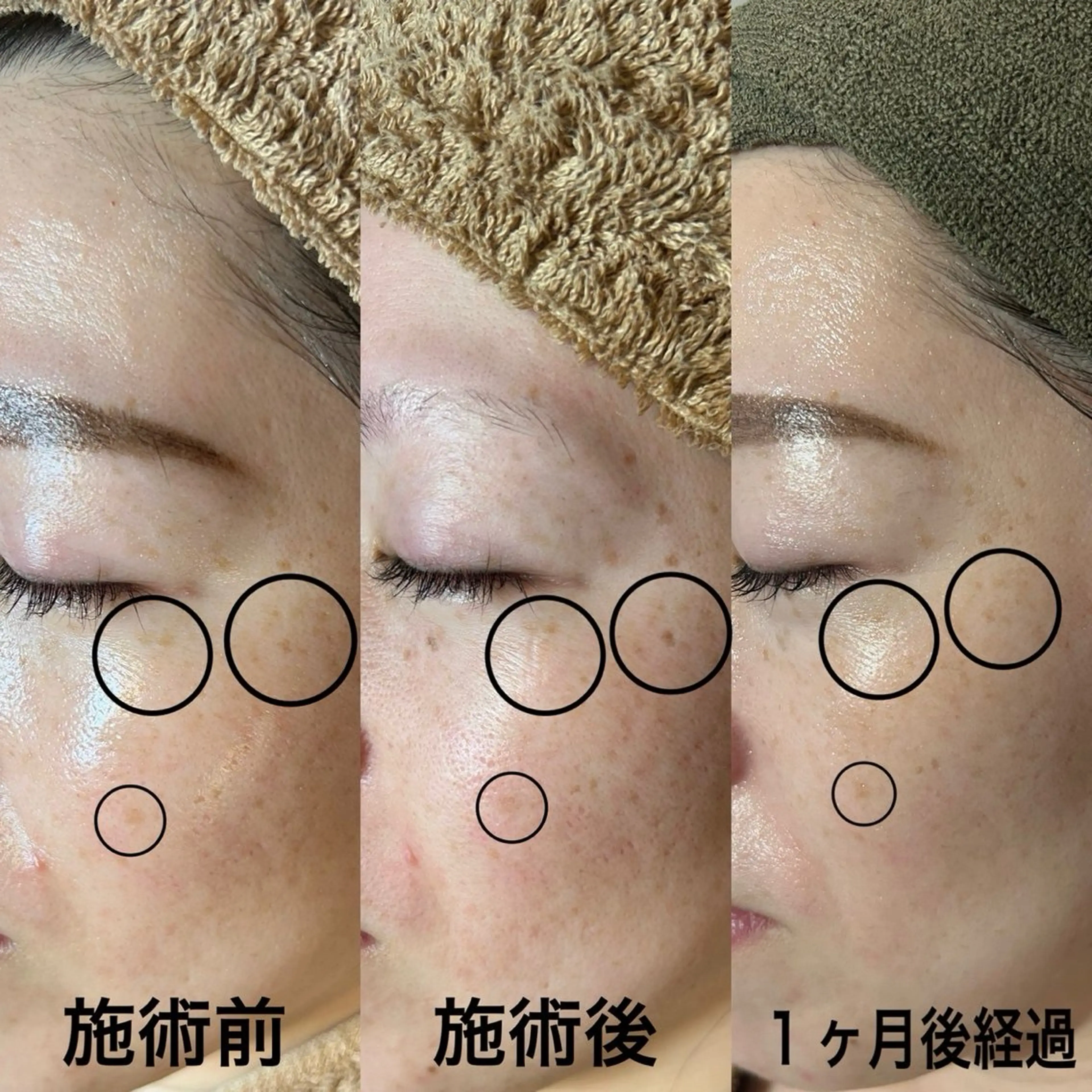 エステ LUMY GRATiAEのエステ・リラクイメージ