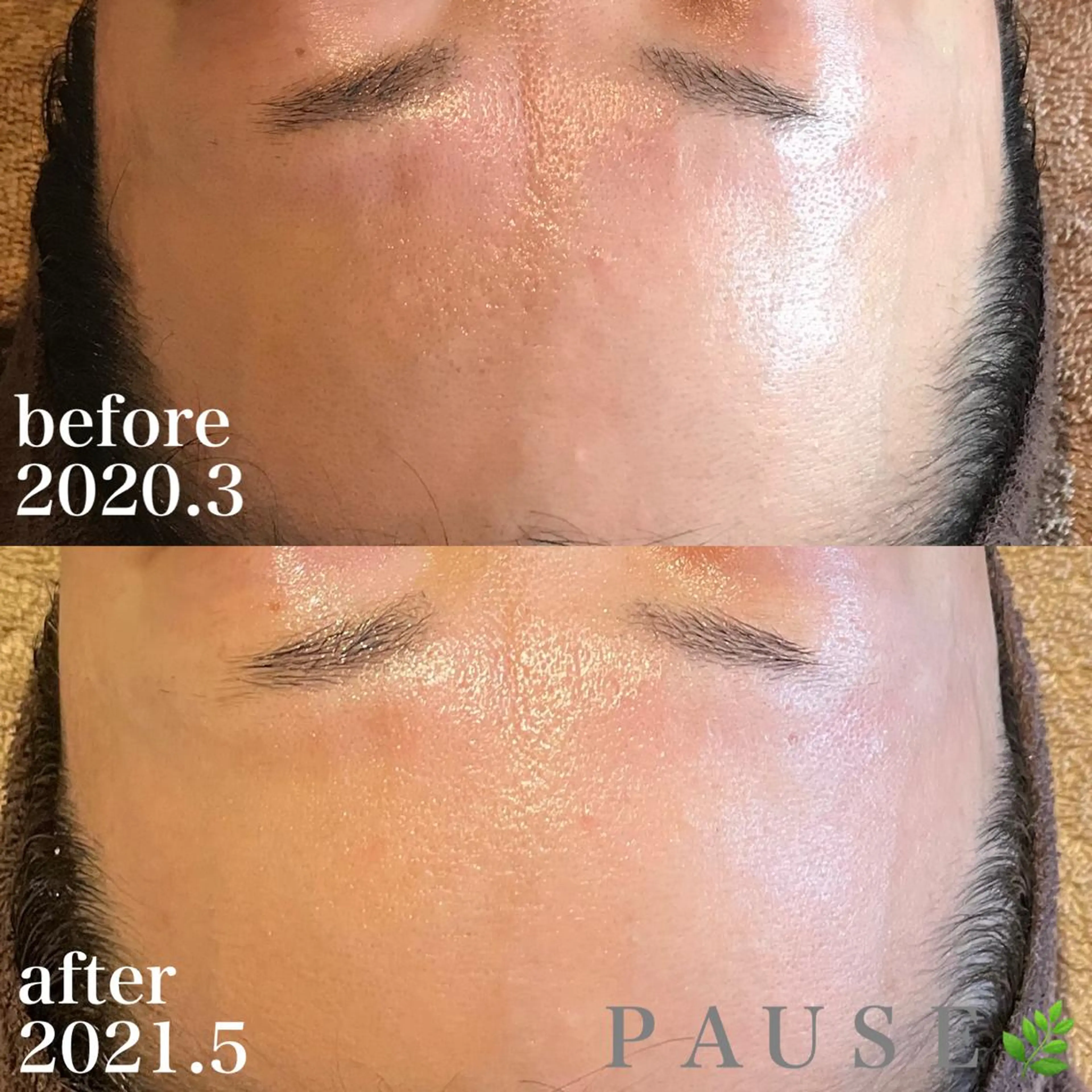 エステ 浜野 恵美のエステ・リラクイメージ