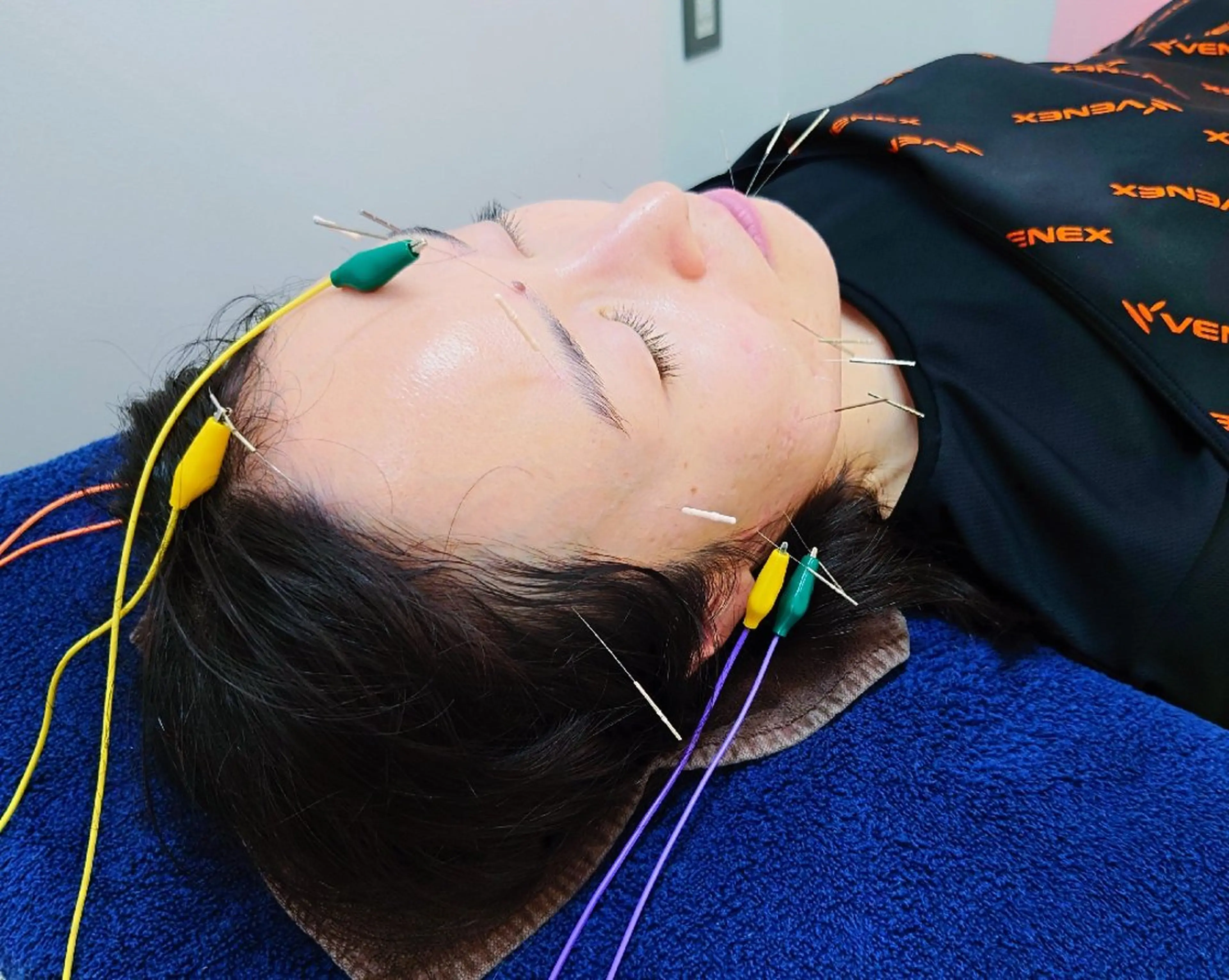 スカイブルー 鍼灸接骨院　佐々木のエステ・リラクイメージ