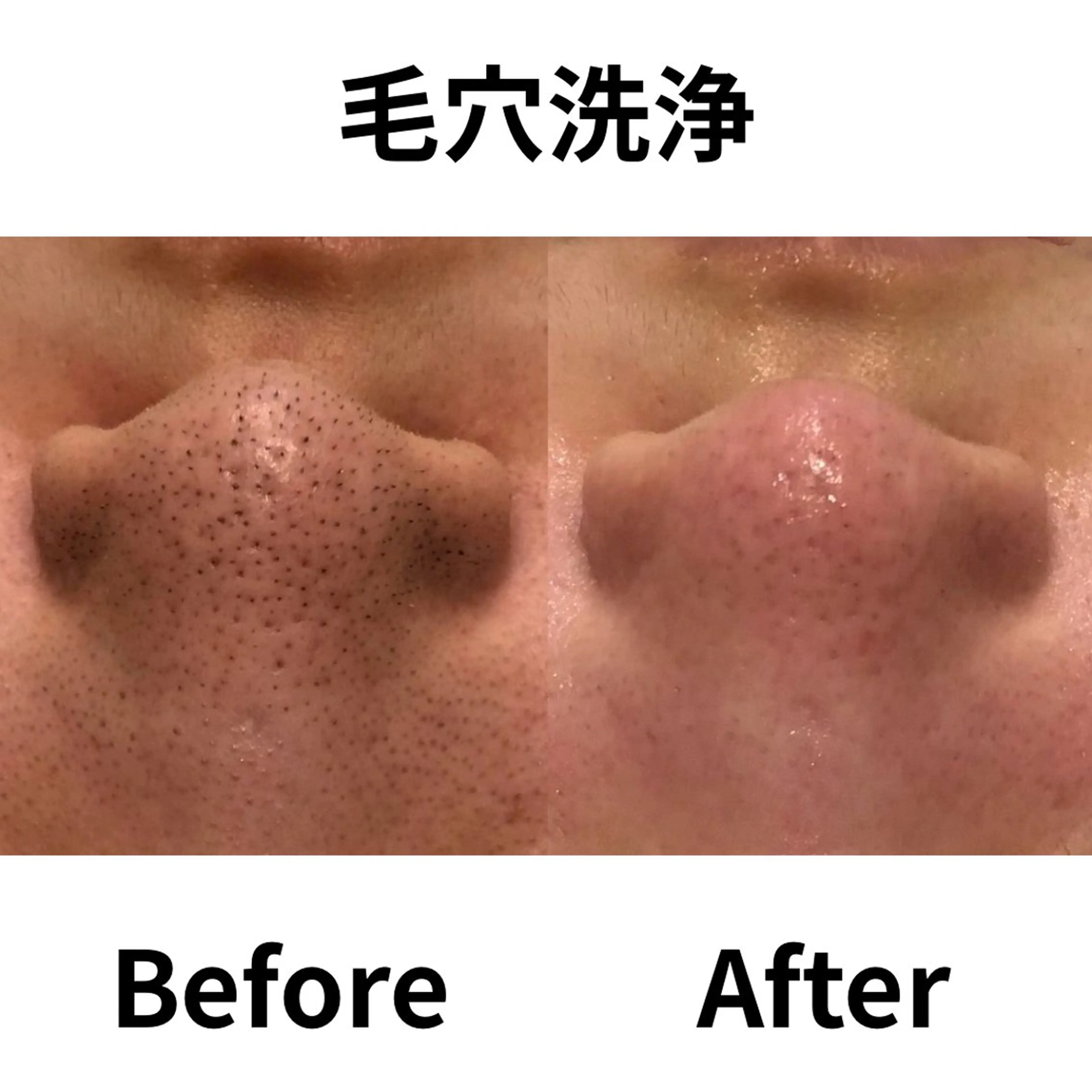 林 陽向のエステ・リラクイメージ