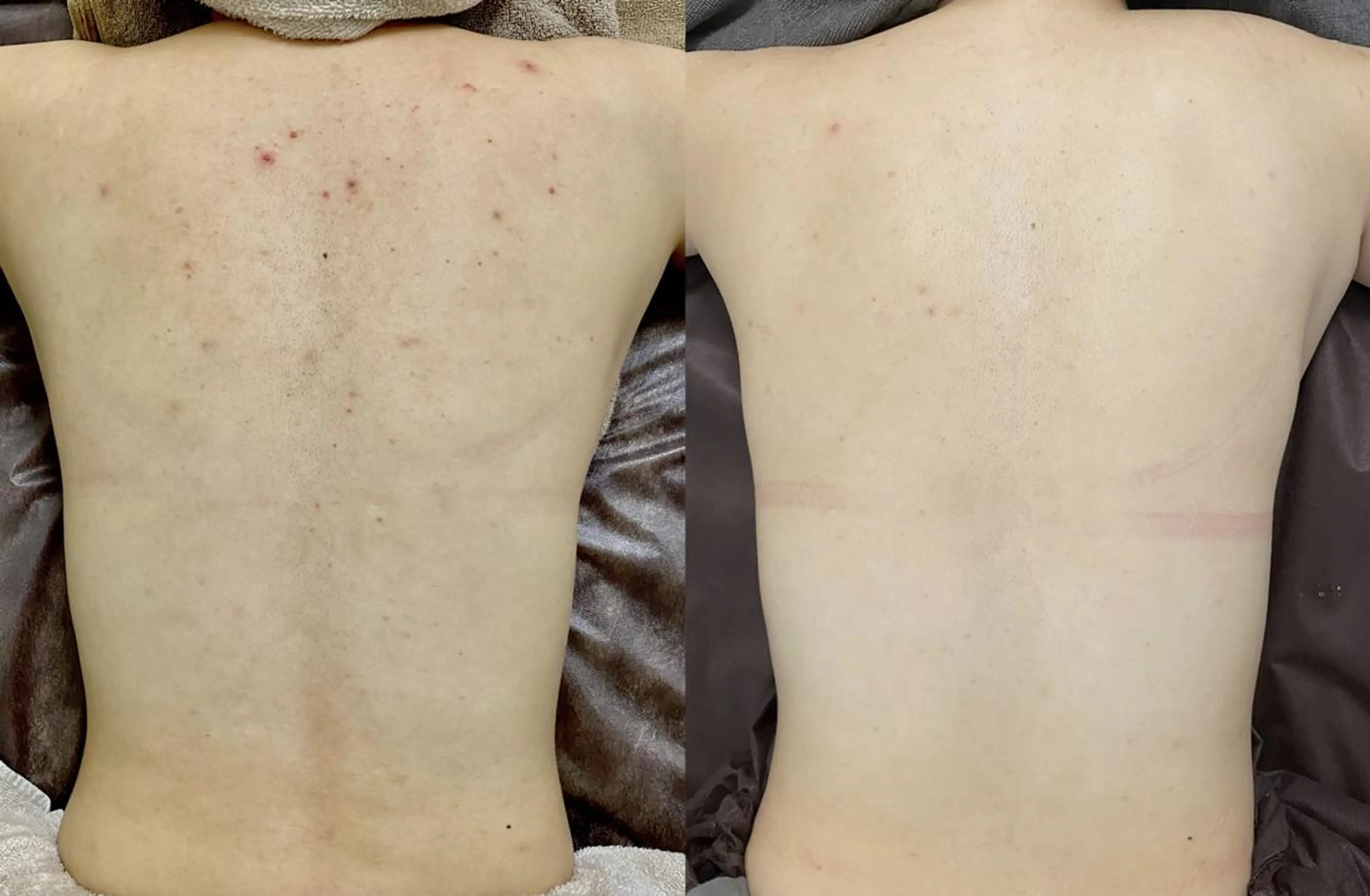 NOBLE 新宿本店のエステ・リラクイメージ