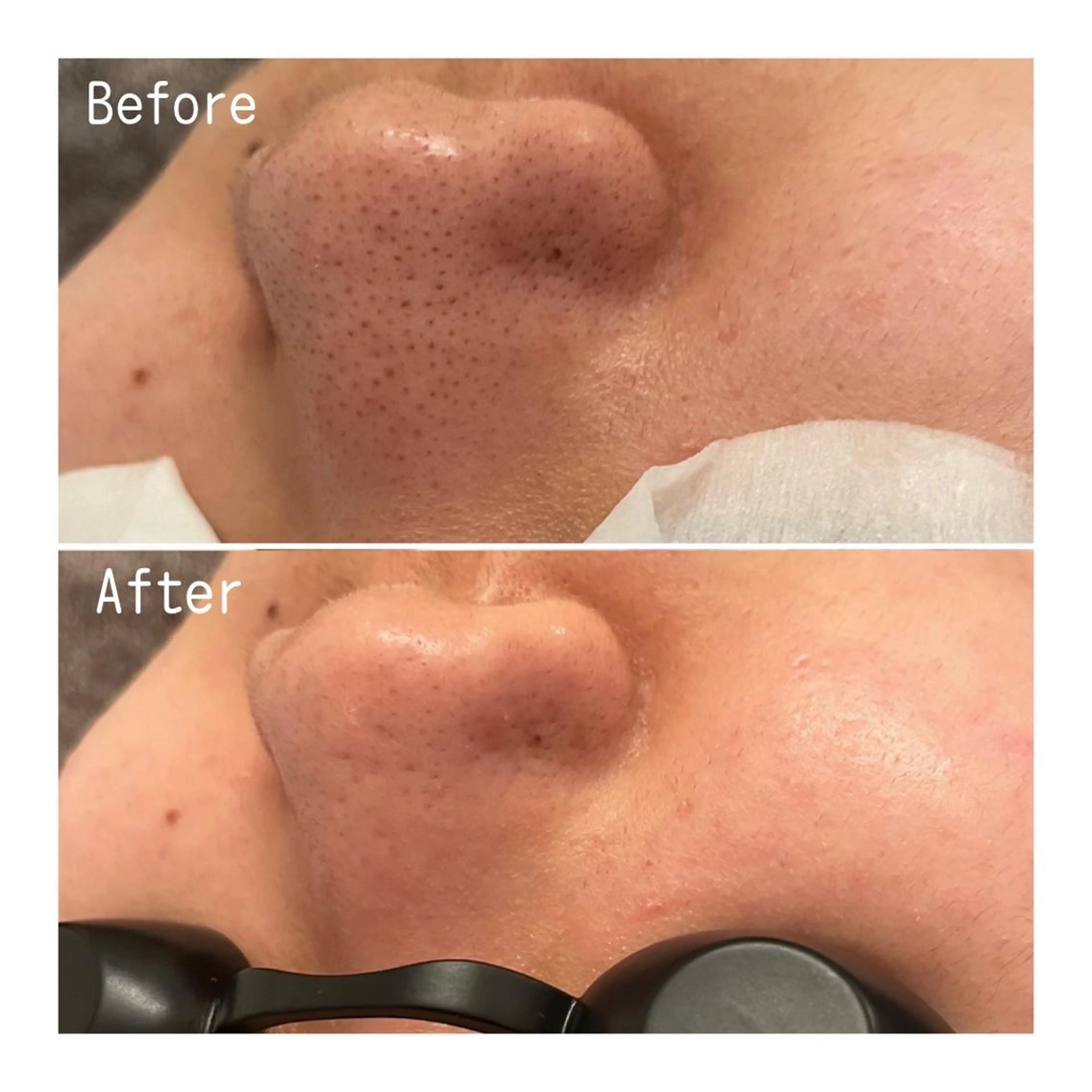 Remina clinical salon所属・ハイフ美肌専門 Remina.c.sのエステ・リラクイメージ