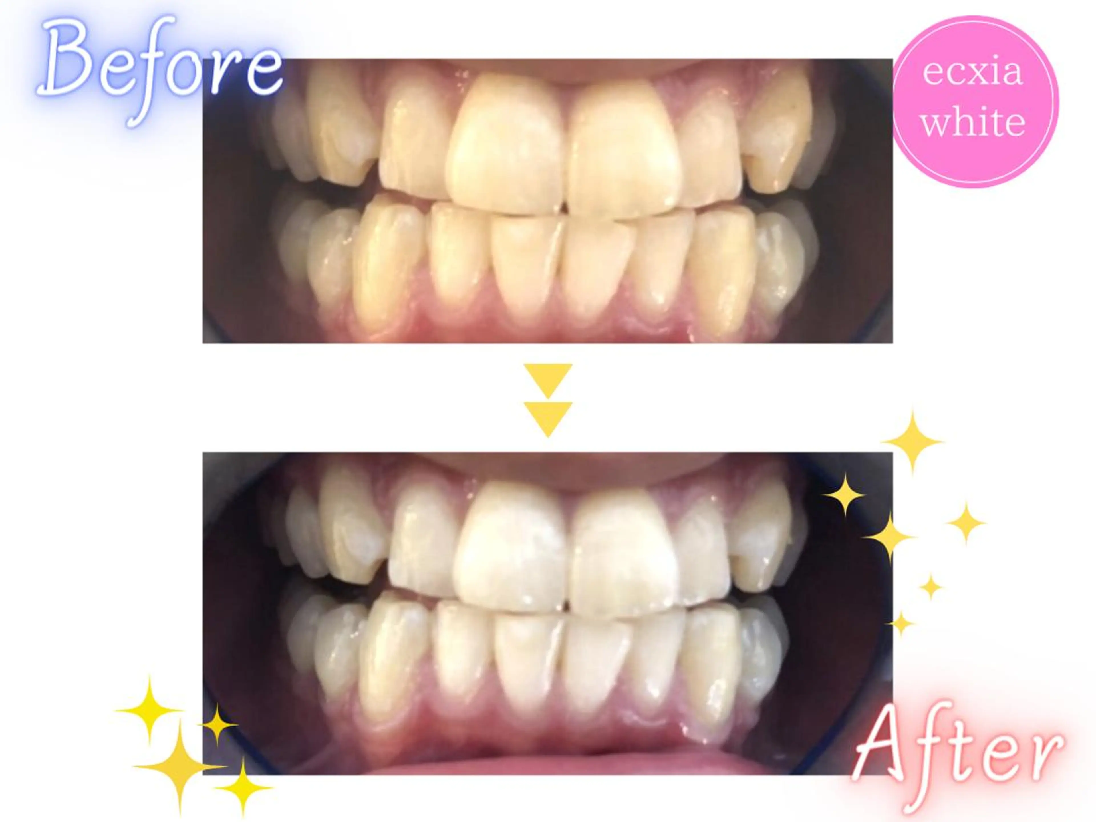 セルフホワイトニング エクシア渋谷駅西口店のその他イメージ