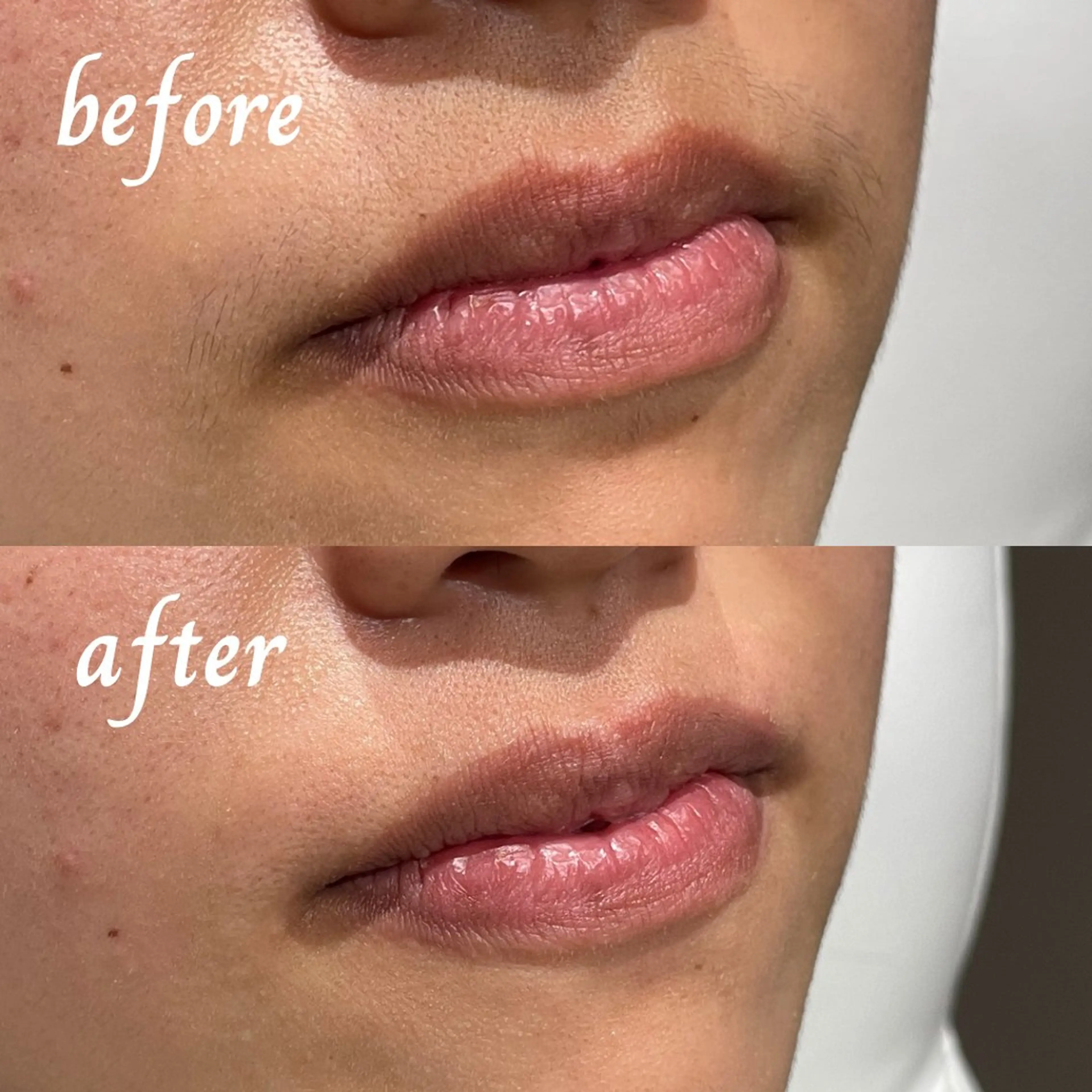 charm ai所属・高野 紗南のエステ・リラクイメージ