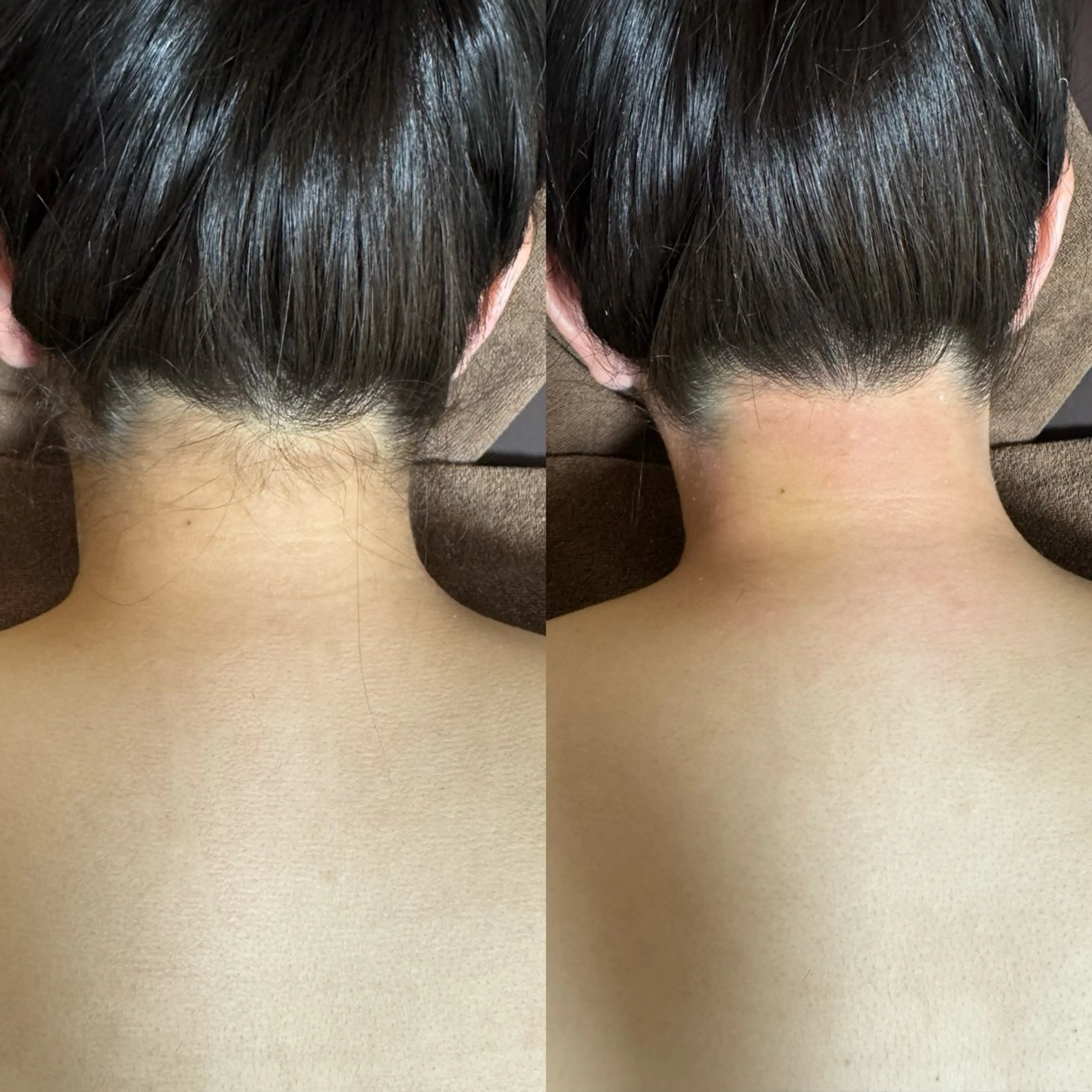 【ブライダル向け】プレ花🆗🌼背中上部シェービング＆うなじワックス👰‍♀️✨　¥5,400の写真