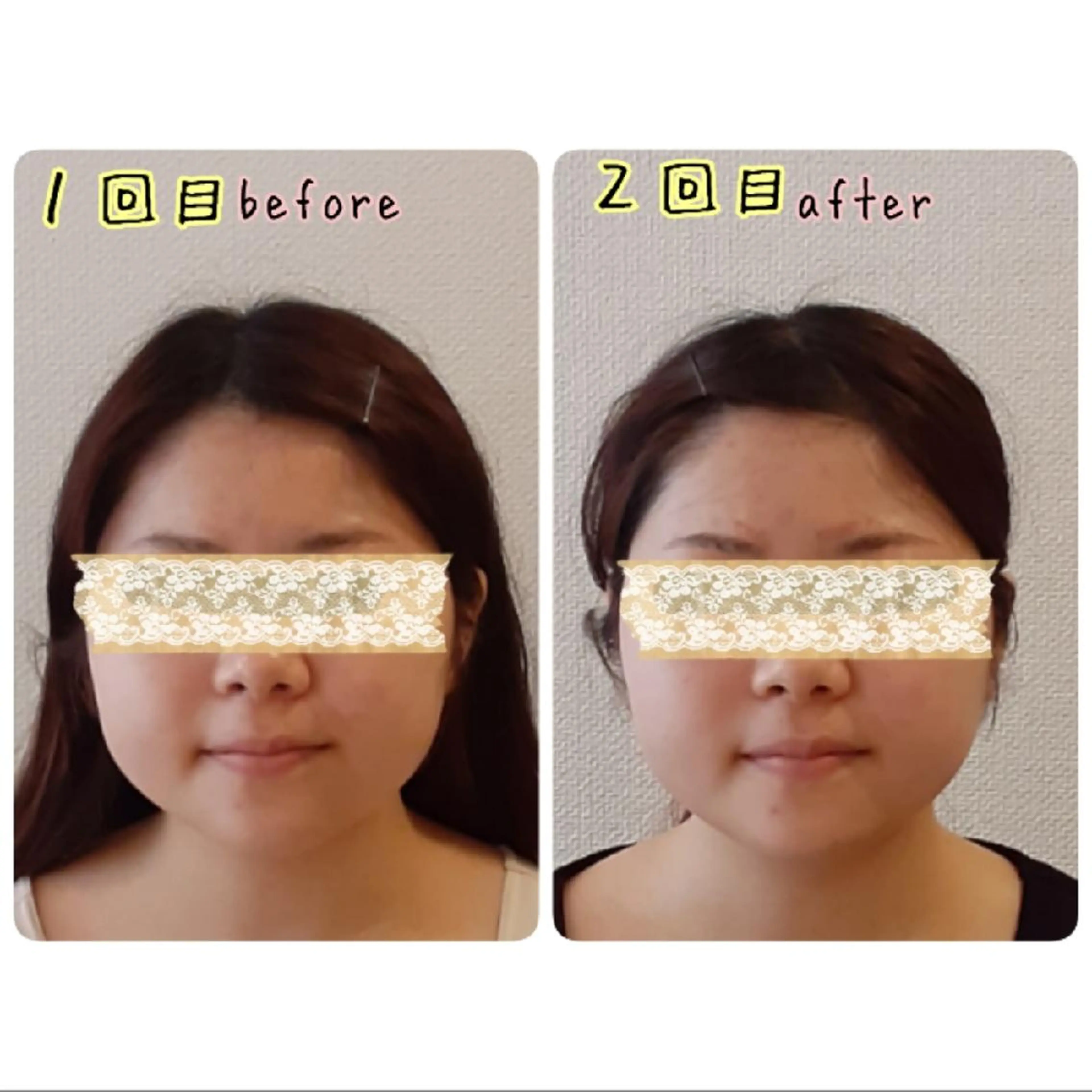 女性専門 Luna time 整体院所属・Luna time  整体院　金子ゆかのエステ・リラクイメージ