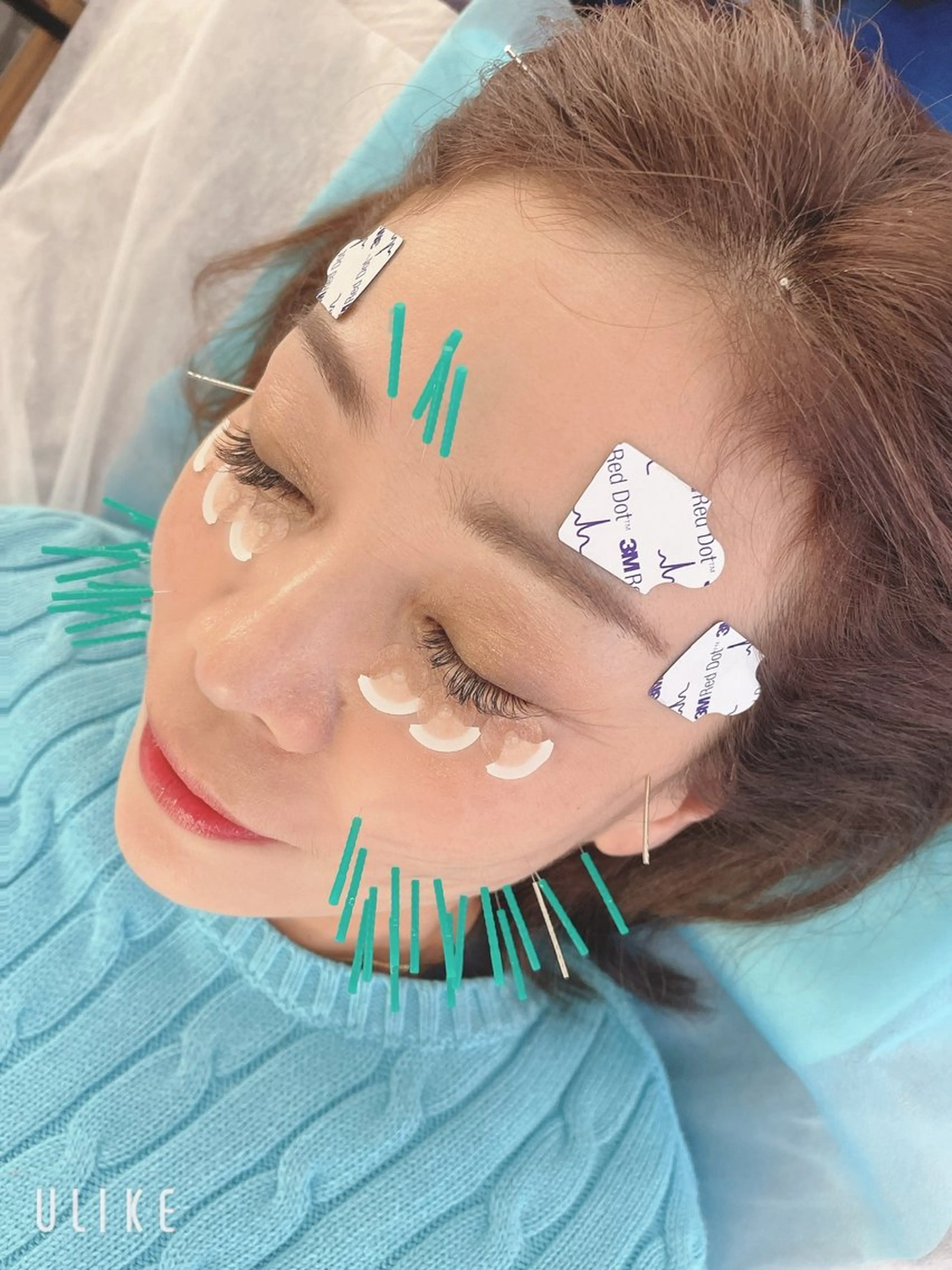 エステ リラク 小顔美容鍼専門サロン 渋谷YZのエステ・リラクイメージ