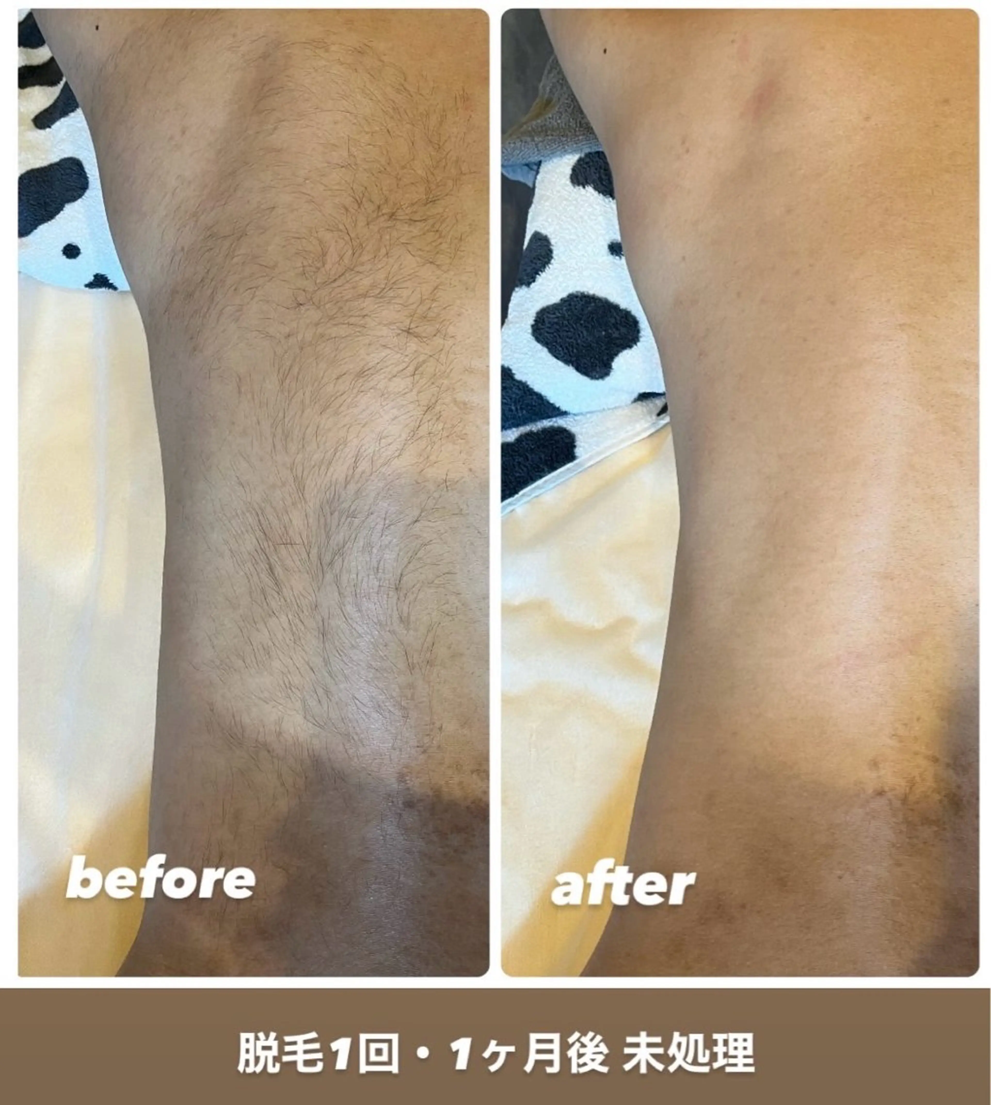脱毛 blue.【都度払い脱毛&フェイシャルサロン】所属・blue.💙【 脱毛&フェイシャル】のエステ・リラクイメージ