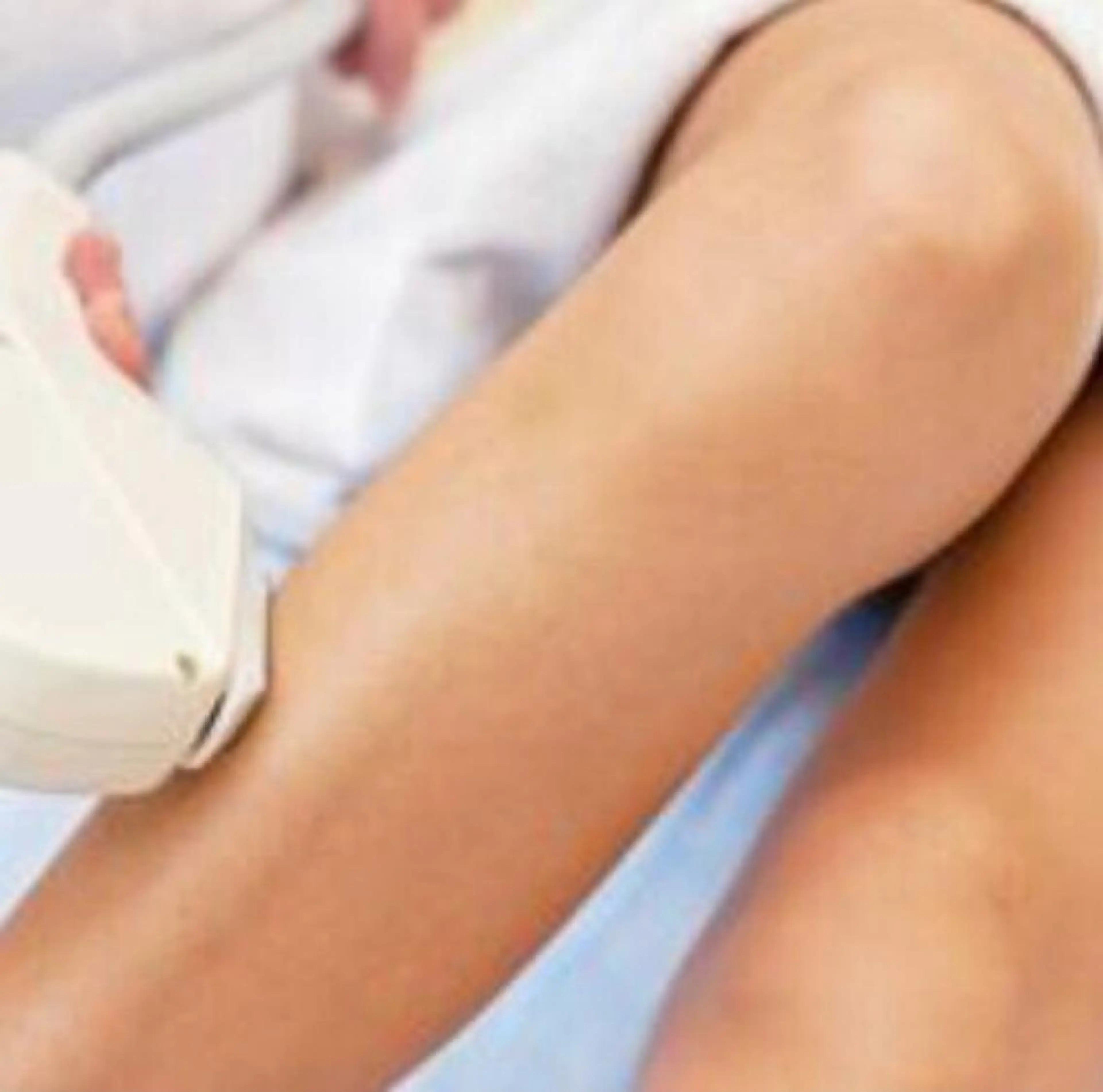 【ミニモデビューキャンペーン】ひざ下&足指脱毛の写真