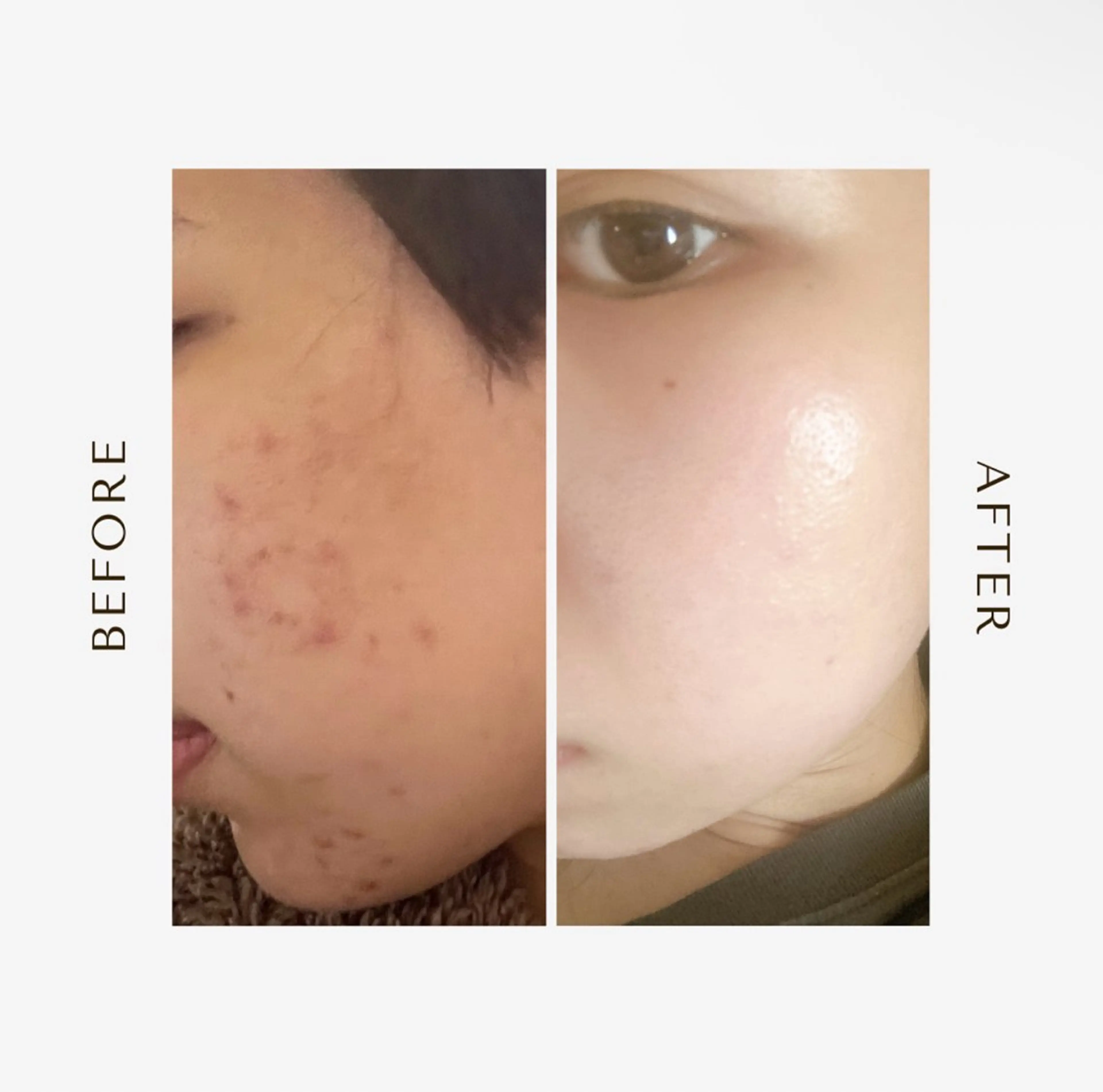 POLAあべのルシアス店所属・エステサロン れいなのエステ・リラクイメージ