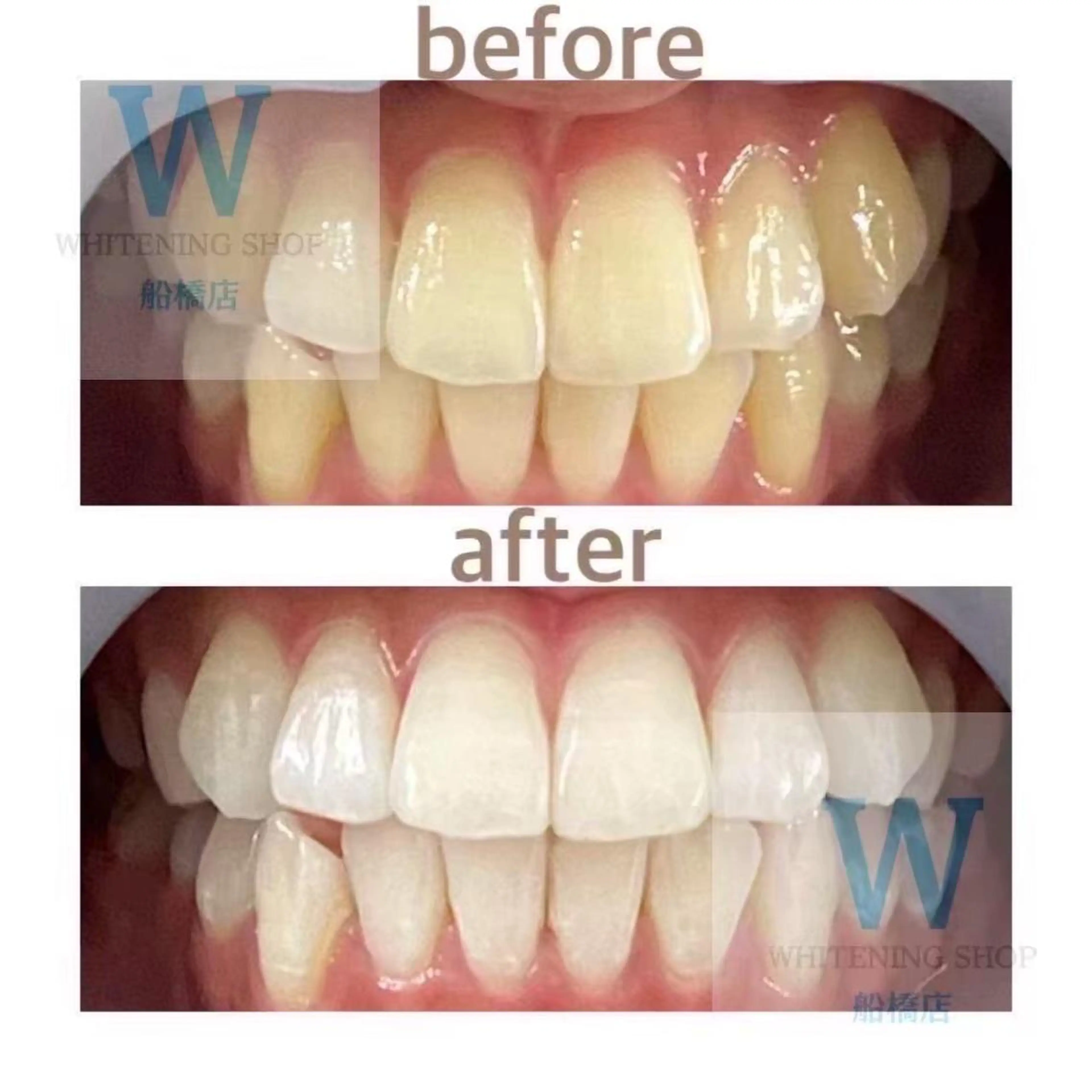 ホワイトニング ショップ船橋店🦷のエステ・リラクイメージ