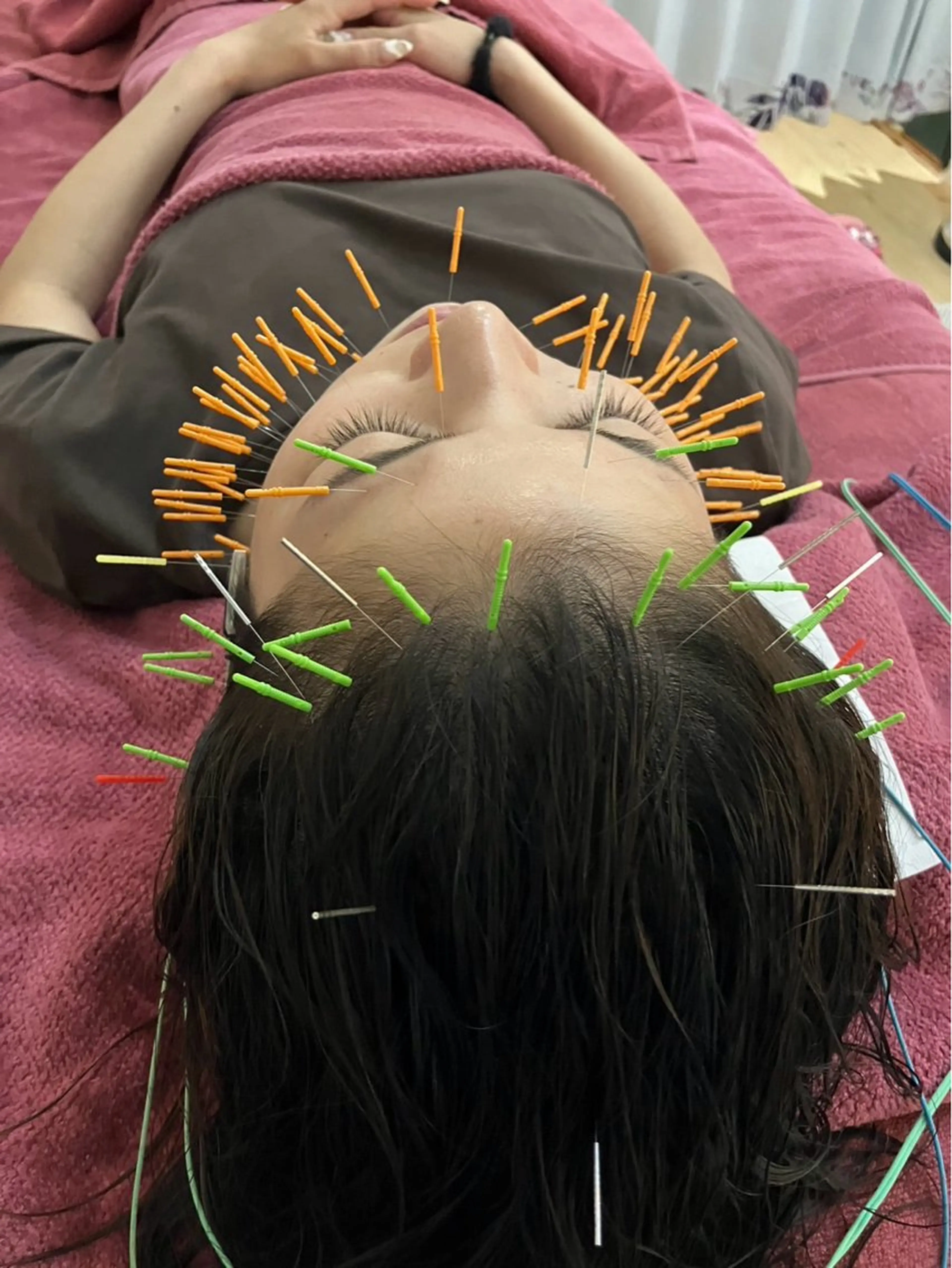 エステ リラク 美容鍼灸女性専用 りんご鍼灸治療院のエステ・リラクイメージ