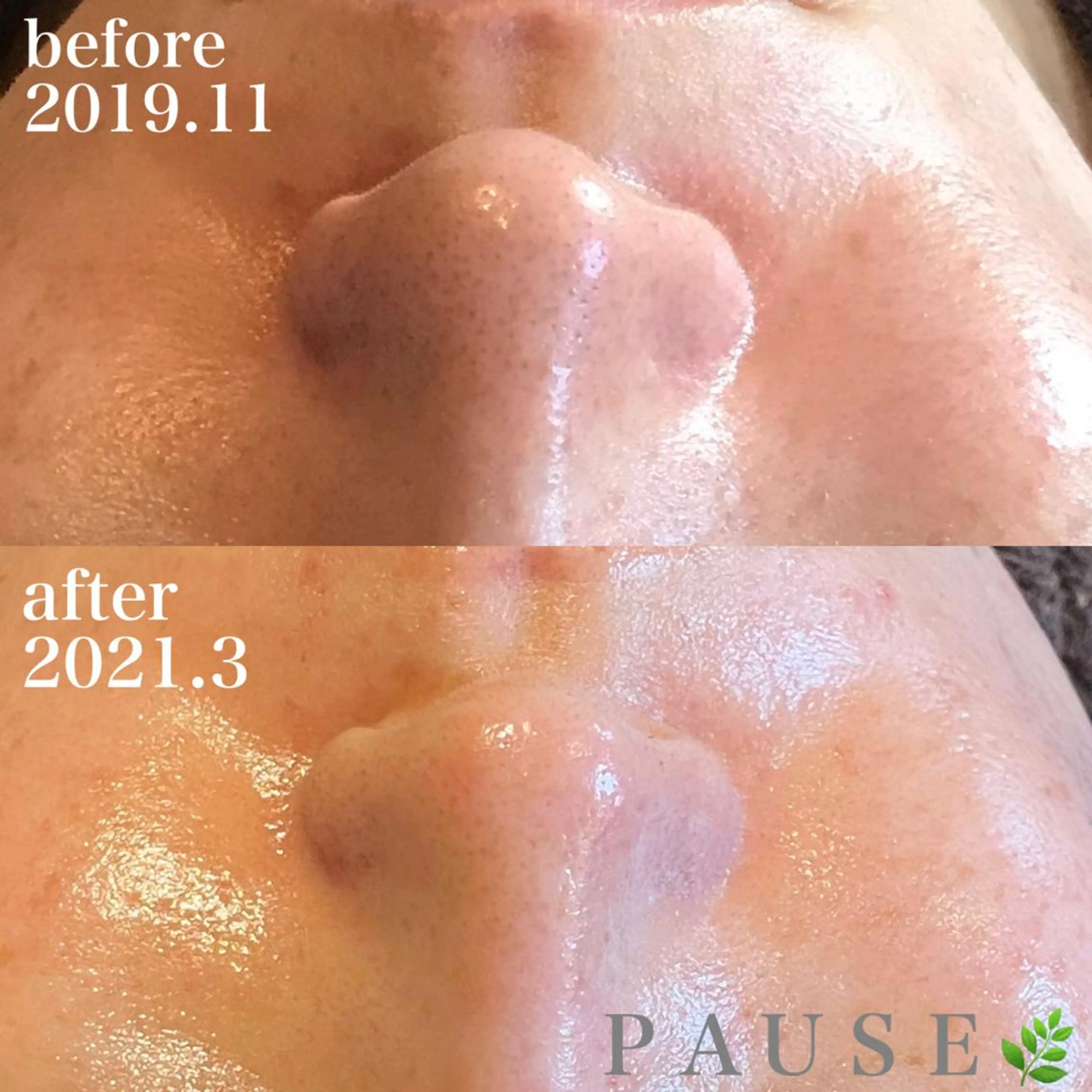 エステ 浜野 恵美のエステ・リラクイメージ