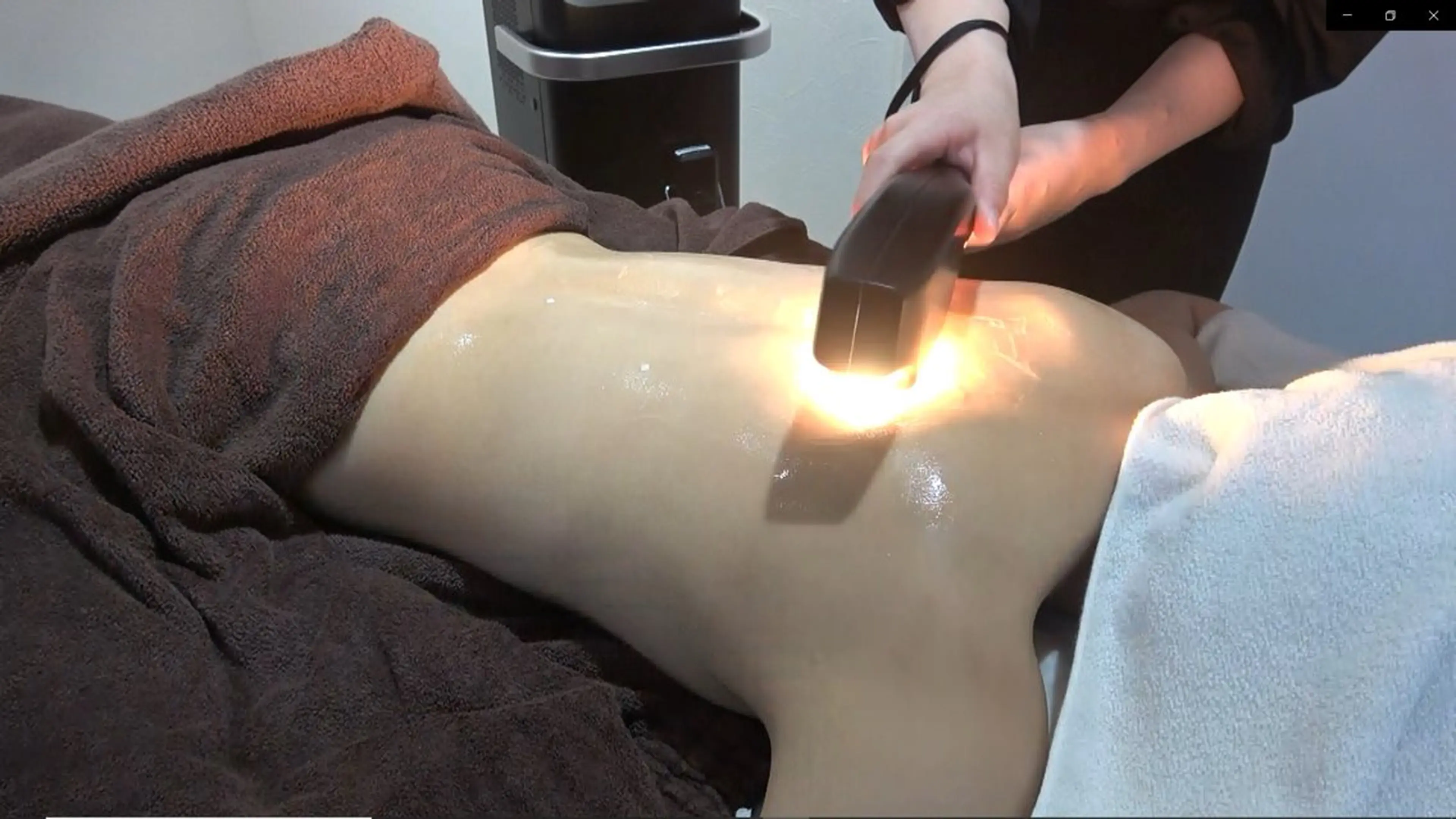 【Ｌパーツ 】・両腕・両足・背中・お腹の写真