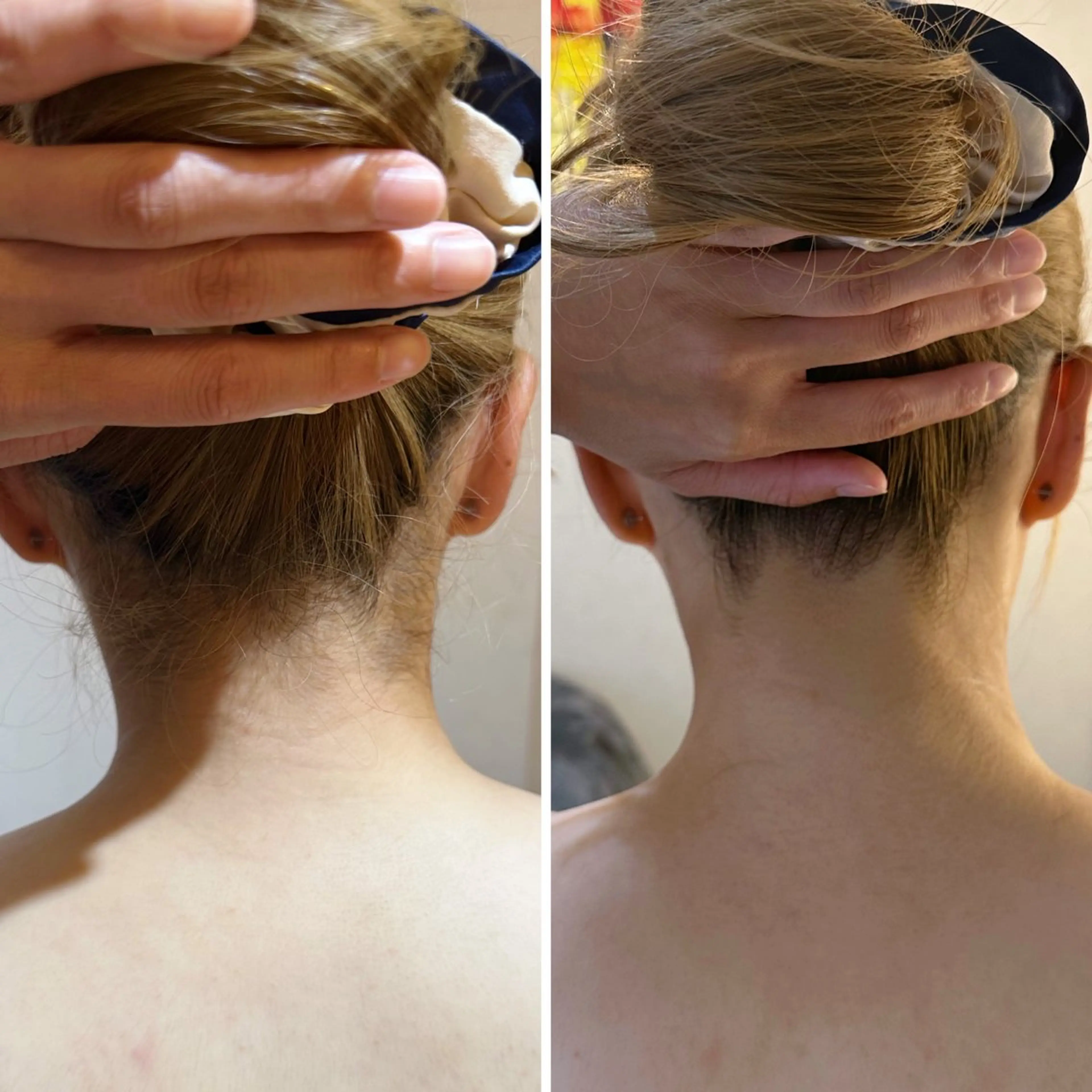 脱毛 うなじ脱毛/美肌脱毛 LABELのエステ・リラクイメージ